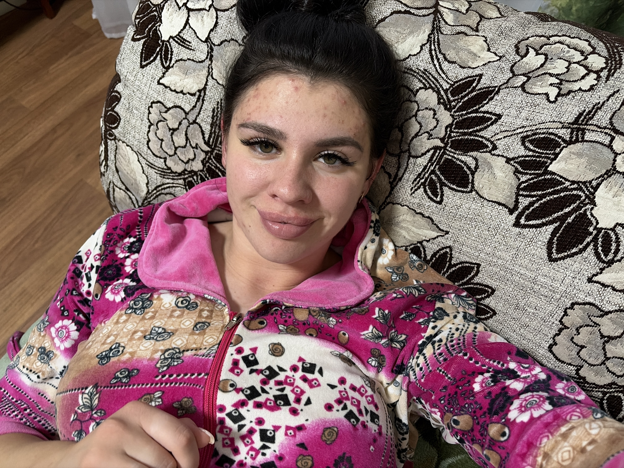 A young woman with dark hair tied up in a bun and noticeable acne on her face is lying on a floral-patterned couch. She is wearing a pink and white floral patterned robe with a zipper. Her left hand is visible, resting on the robe. The couch has a brown and beige floral pattern. The background shows a wooden floor. The image appears to be taken indoors, likely in a residential setting.
