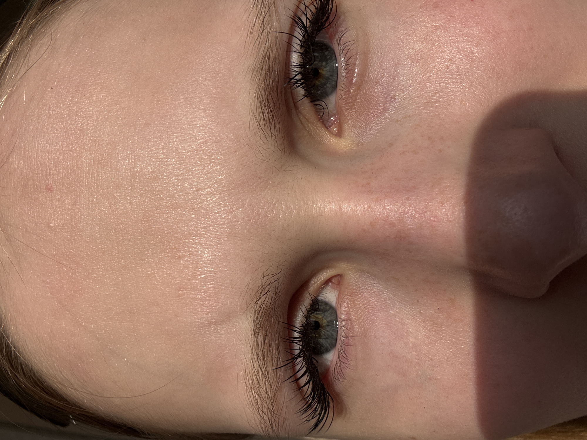 The image shows a close-up of a person's face, focusing on the eye and forehead area. The person has pale skin, visible eyelashes, and grey eyes. The skin appears to have some freckles and minor imperfections. A portion of the nose and cheek are visible, partly shadowed. The image appears to be taken in natural light. There is no information to establish the location in the city of Usolye, Russia.