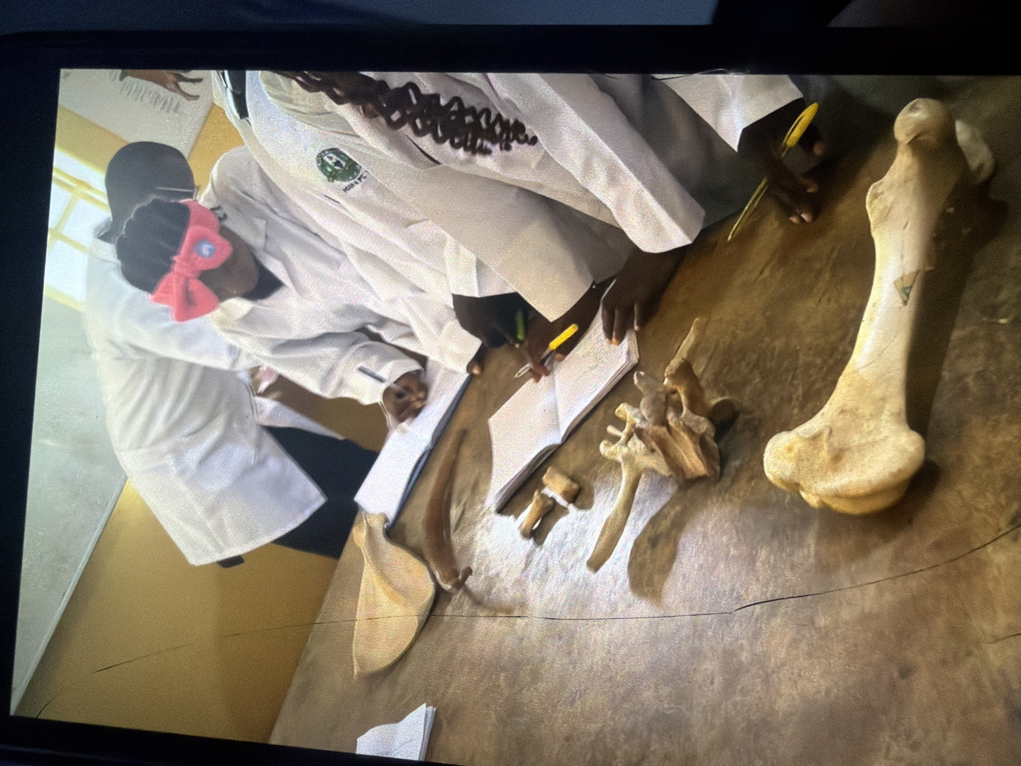 In Bukuru, Nigeria, a group of individuals wearing white lab coats are gathered around a wooden table. The table is covered with what appear to be bones, possibly from an animal, and open notebooks. Some individuals are holding pens and appear to be writing or studying the bones. One individual in the foreground is wearing a pink bow on their head. The environment suggests an educational or scientific setting.