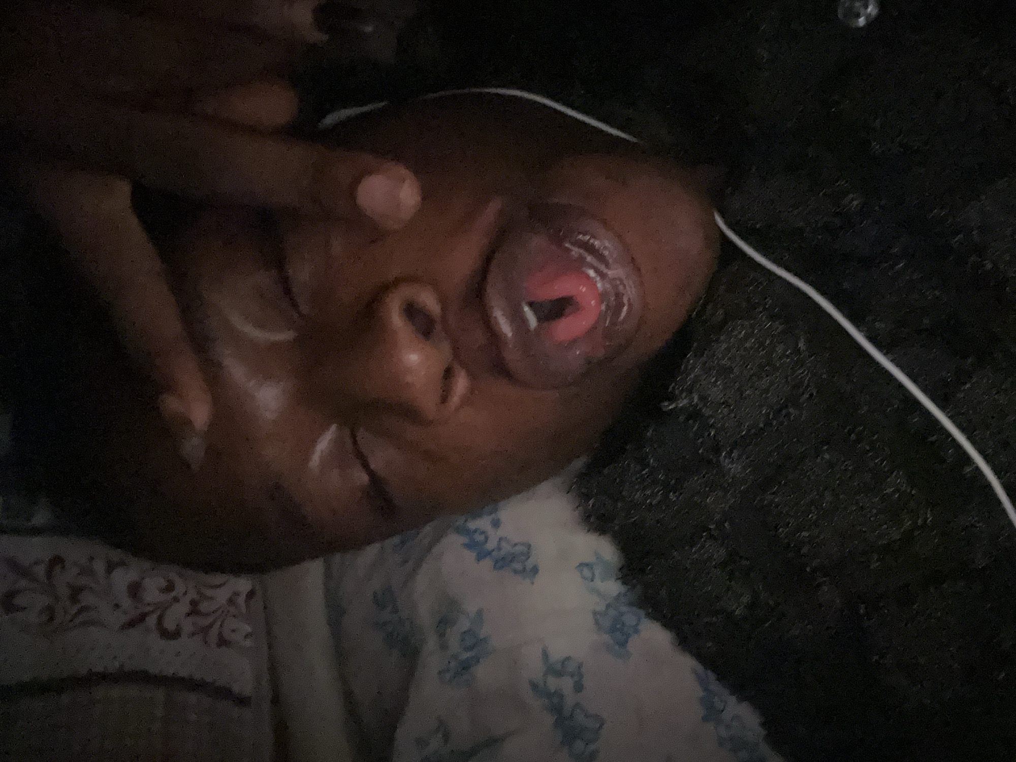 A person with dark skin is lying on a bed with a white and blue floral patterned sheet. The person's eyes are closed and their mouth is open with a dental appliance visible inside. One of the person's hands is near their face. A white cord is visible near the person's head. The background is dark and out of focus.