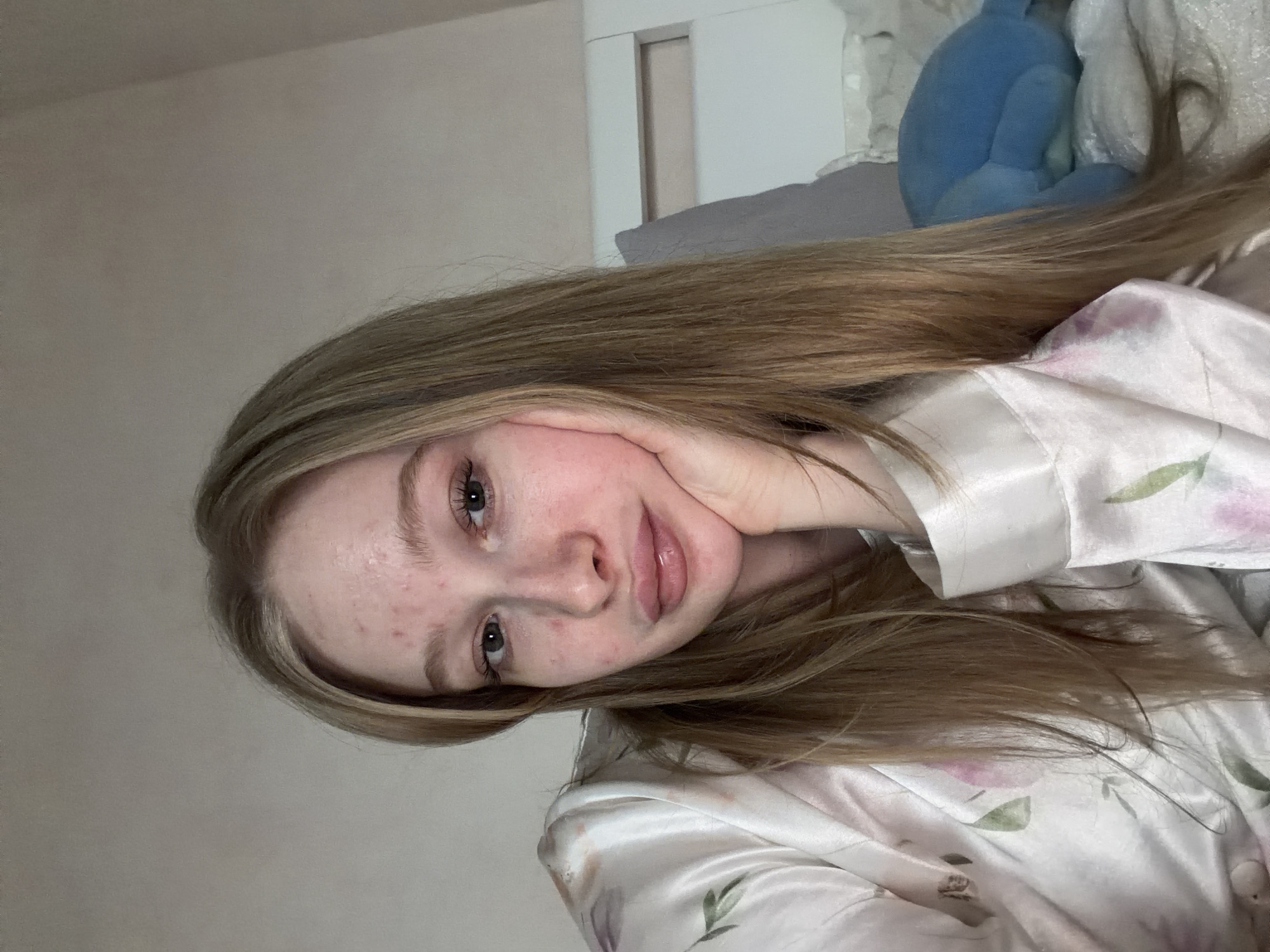 A young woman with long, straight, light brown hair is captured in a close-up, rotated indoor selfie. She has fair skin with visible redness and blemishes on her forehead and cheeks. Her eyes are light-colored, and her lips are slightly parted. She is seen resting her chin on her right hand, which is gently cupping her jawline. She wears a light-colored, possibly satin or silk, top featuring a subtle floral pattern with pink and green accents.
The background suggests an indoor setting, likely a bedroom, with a light blue plush toy or pillow, a grey pillow, and white furniture elements visible. The lighting is soft and diffuse, indicating an indoor environment without direct sunlight. The woman's expression is relaxed, with a subtle, gentle smile as she looks directly at the camera. There is no visible text in the image. The scene conveys a casual and personal moment. The location context for this image is Rossiyskiy, Russia.