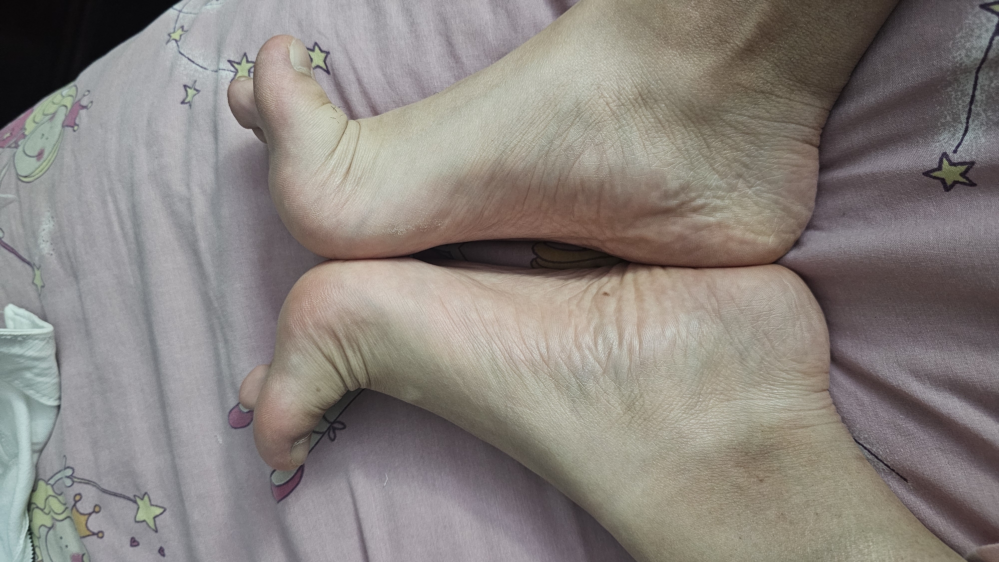 The image shows two human feet resting on a pink bedsheet with a cartoon print. The feet are pale, with visible wrinkles and skin texture on the soles. The toes are slightly flexed. The background is the patterned bedsheet with stars and cartoon figures. There is no indication of a location in San Bernardino Tlaxcalancingo, Mexico.