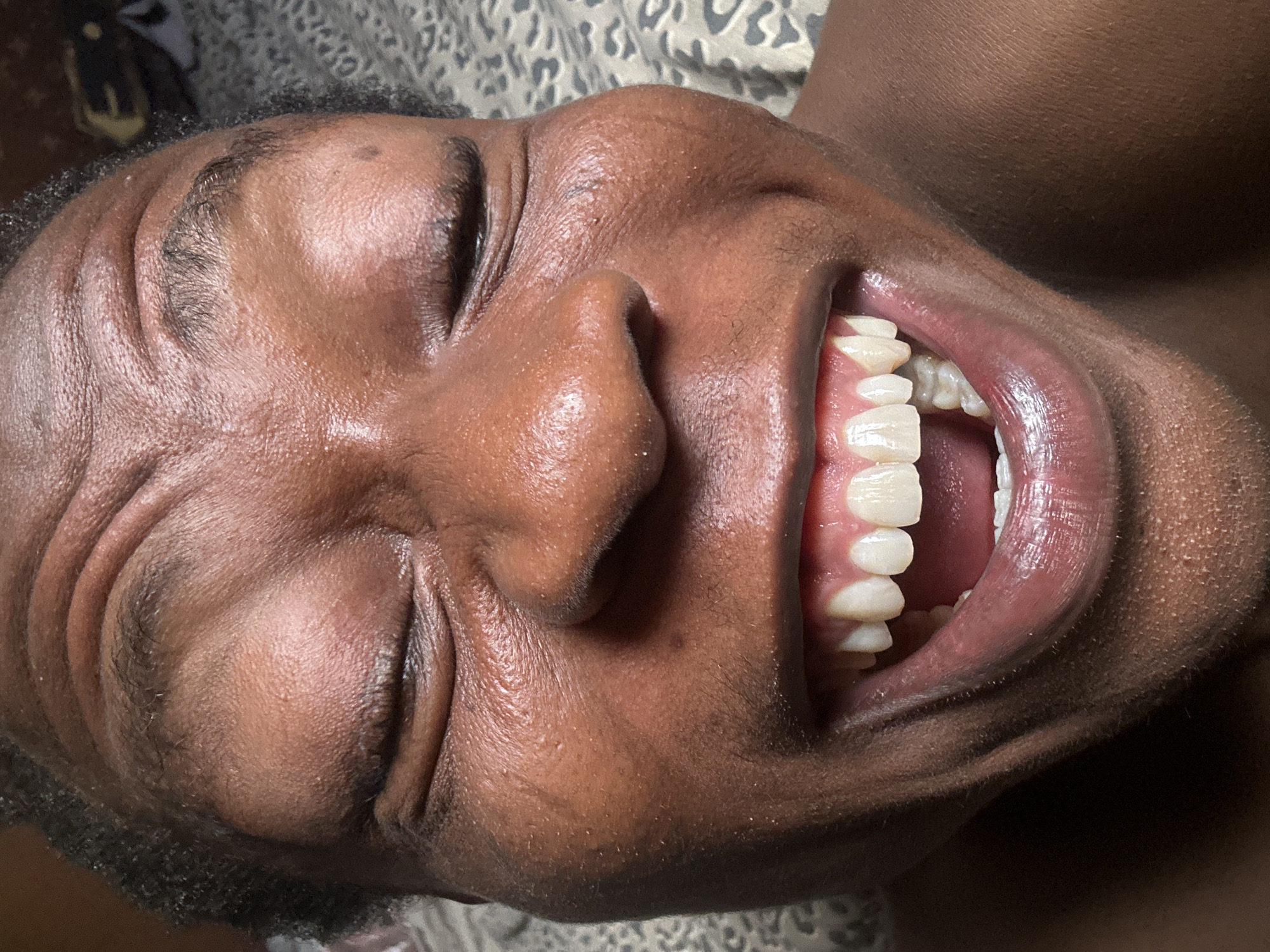 A close-up, angled, and indoor shot shows a person with dark skin lying down and facing upward with their eyes closed and mouth open. The person's teeth are visible. The background includes what appears to be patterned fabric.