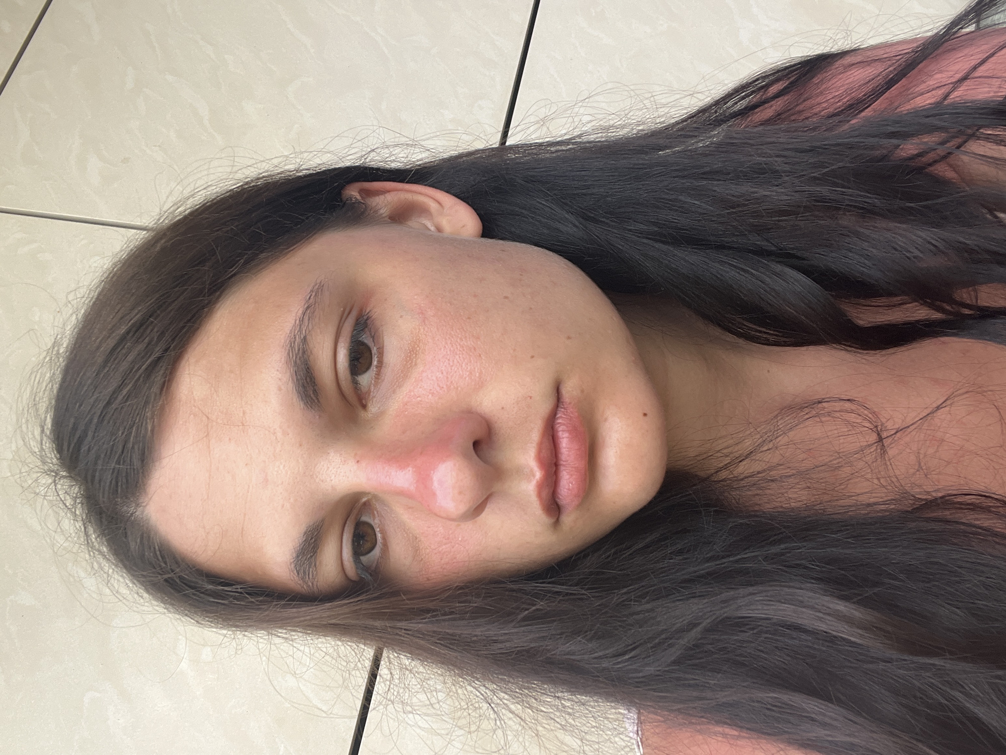 A young woman with dark hair is captured in a close-up, head-and-shoulders portrait. Her skin appears flushed, particularly around her nose and cheeks, suggesting potential sunburn. She is looking directly at the camera with a neutral expression. The background consists of a tiled wall, the neutral tones of which contrast with the subject's reddened skin. The lighting is bright, casting subtle shadows and highlighting the texture of her skin and hair. There is no discernible activity or interaction occurring in the image, and the setting appears to be outdoors, possibly in a residential or public area. The provided crops highlight specific areas of her face and hair, emphasizing the details of her features and the texture of her skin. There is no information available that places this image in Lermontovo, Russia, or any other specific location.