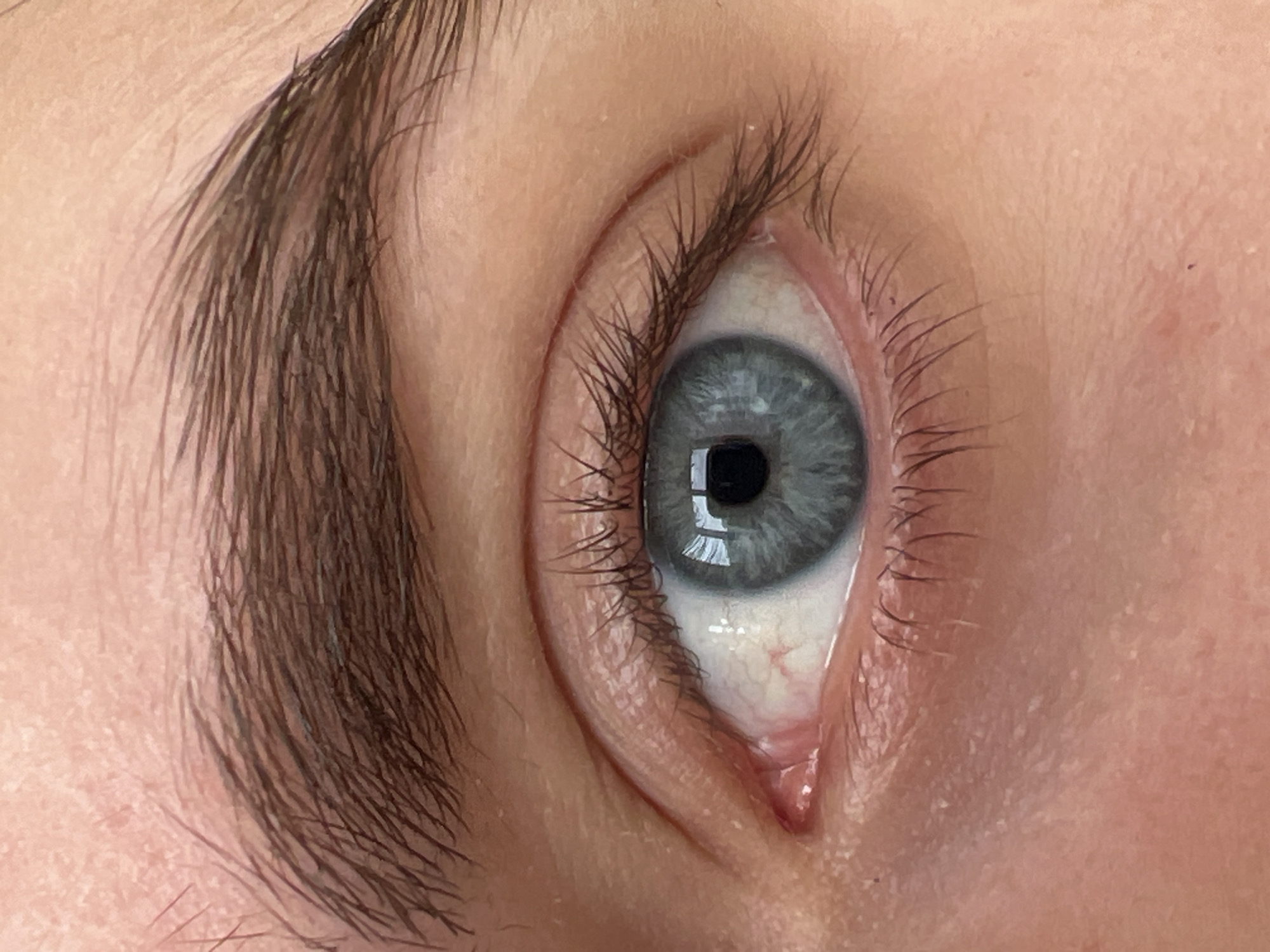 Close-up image of a human eye with gray iris and dark pupil. The eye is surrounded by lashes and skin. A prominent eyebrow with dark brown hairs is visible above the eye. Fine wrinkles and skin texture are noticeable. There is a small amount of fluid in the lower inner corner of the eye. The location is not apparent from the image and no information suggests it is Ternopil, Ukraine.