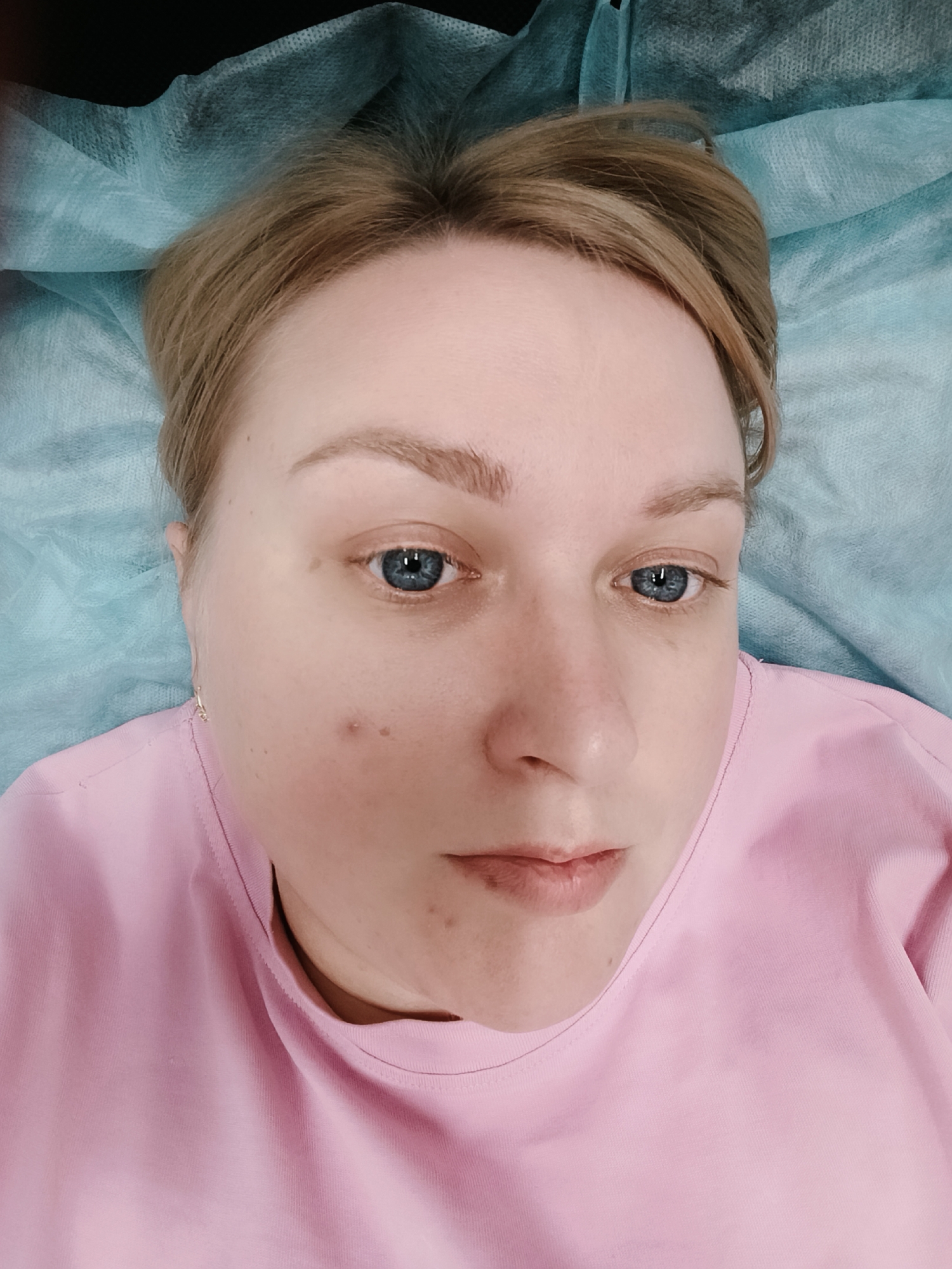 The image is a close-up portrait of a woman, framed from her upper chest to the top of her head. She is lying down, looking directly at the camera with a neutral, calm expression. She has fair skin, blue eyes, and light brown or blonde hair that appears to be pulled back, with some strands visible near her temples. Small moles or freckles are visible on her face, particularly on her right cheek. A small, metallic earring is present in her visible left ear.
She is wearing a simple pink t-shirt with a round neckline. Her body, shoulders, and the area around her head are covered by a light blue, disposable-looking sheet or fabric, characteristic of those used in medical or clinical settings. This suggests she might be on an examination table or similar surface indoors. The background consists entirely of this blue material, indicating a focused, possibly clinical, environment.
The lighting is even, without harsh shadows, typical of an indoor setting with artificial light. There is no discernible activity taking place other than the woman posing for the photograph. No text is visible in the image. The overall impression is one of a relaxed, candid moment within what appears to be a medical or wellness context, consistent with a location like Chaikovsky, Russia.