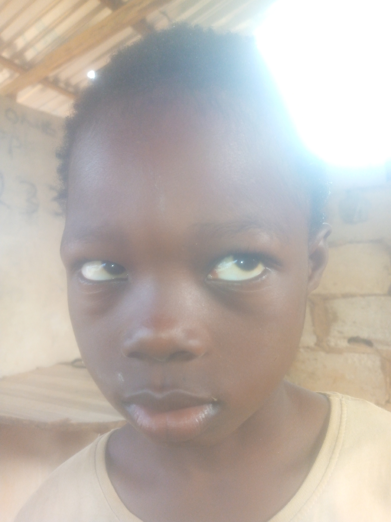 A close-up shot of a young, dark-skinned individual with slightly crossed eyes is captured indoors. The person's skin is smooth and their lips appear slightly glossy. They are wearing a light-colored shirt. The background reveals a rustic setting with exposed brick walls and wooden beams overhead. The location is Unknown, Unknown.