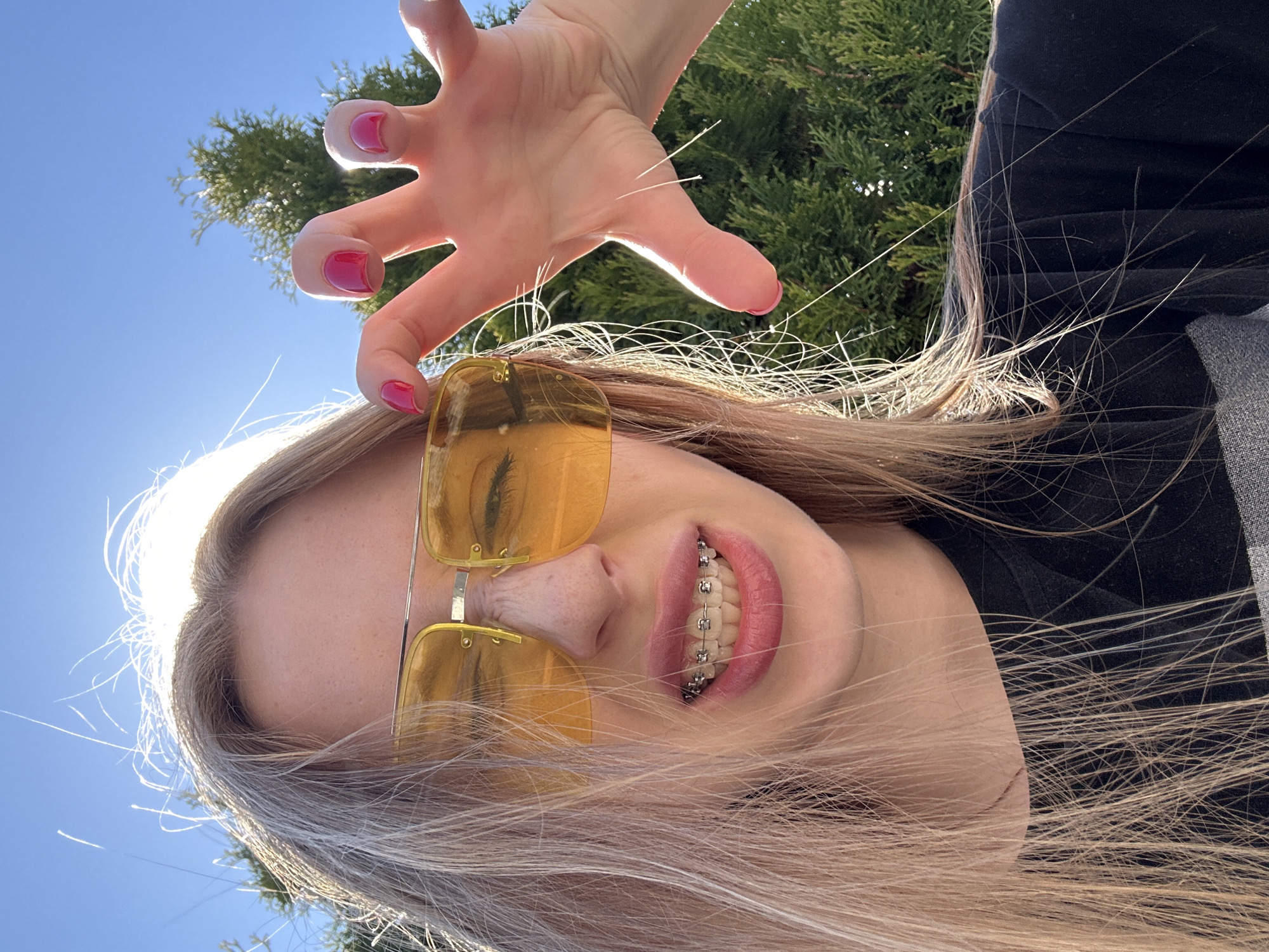 A young woman with long blonde hair, wearing yellow sunglasses and dental braces, is seen from a low angle. Her right hand is raised above her head with her fingers splayed. She has pink nail polish on her fingers. In the background are green trees and a clear blue sky. The photo was taken outdoors. No specific location in Chaikovsky, Russia, can be determined from the image.
