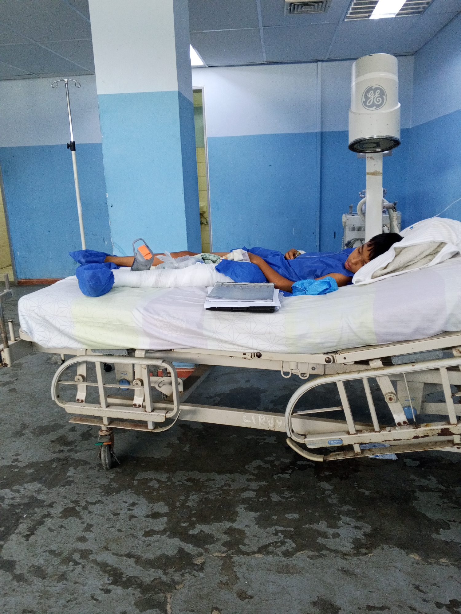 A young boy lies on a hospital bed with his legs bandaged and elevated. He is wearing a blue hospital gown and appears to be sleeping. A medical IV stand is visible to the left of the bed, and a GE medical light fixture is mounted on the wall behind the bed. The room is painted blue and white, and the floor is a dark, mottled grey. The hospital bed is equipped with wheels and side rails. There is a tablet computer on the bed next to the boy.