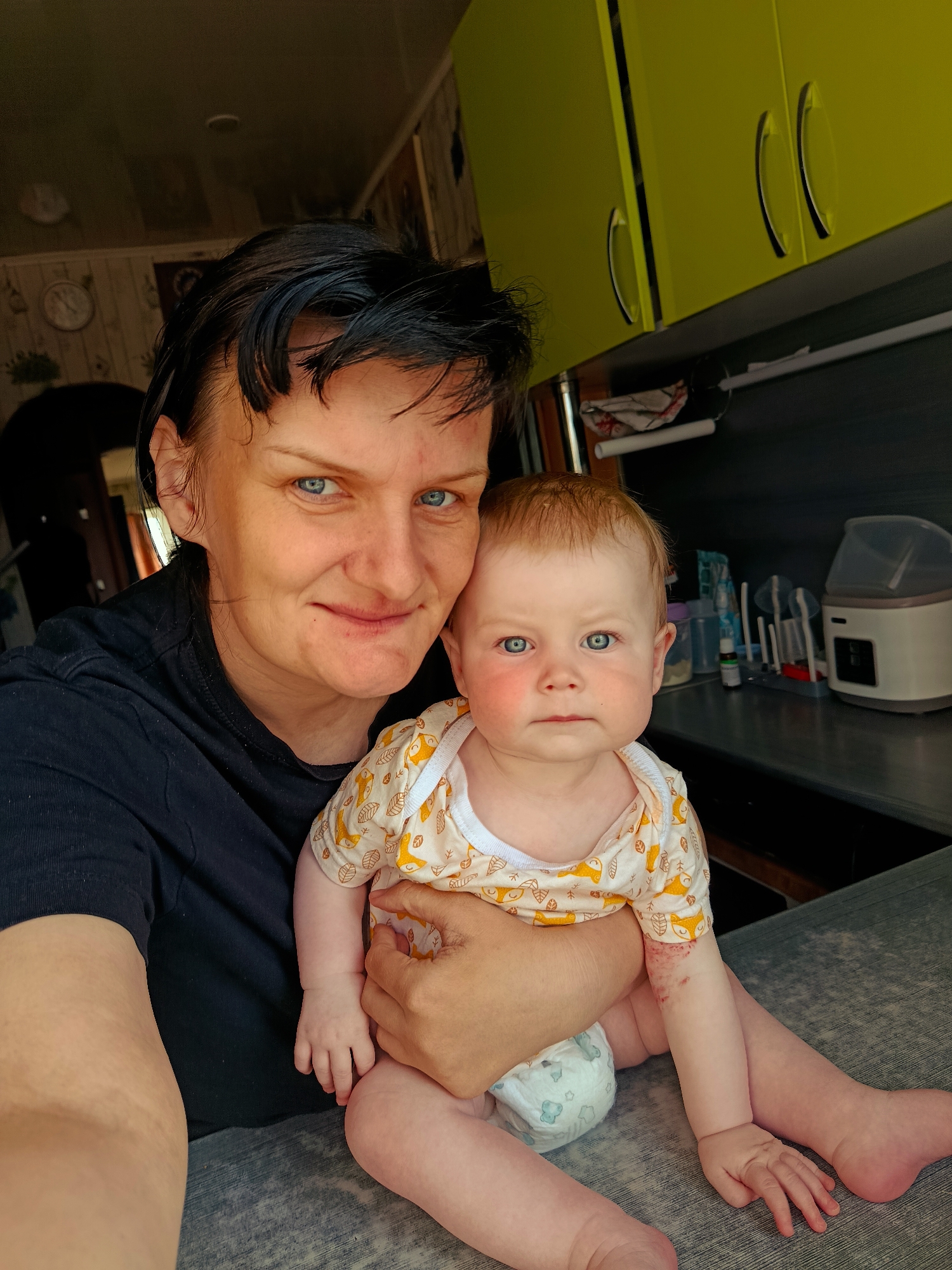 This media file presents a selfie of a woman holding a baby indoors, likely in a kitchen or utility area within a home in Фоки, Russia. The woman, who appears to be the mother, has dark hair and striking blue eyes, and is wearing a black t-shirt. She looks directly at the camera with a soft, gentle smile.
The baby, held in the woman's arm, has light hair and bright blue eyes, with noticeable reddish cheeks. The baby also looks towards the camera, displaying a neutral expression. They are dressed in a light-colored onesie patterned with orange fox-like creatures and leaves, and wear a white diaper with light blue designs. A patch of red, possibly irritated skin, is visible on the baby's right arm near the elbow.
The background reveals bright lime green upper cabinets with silver bar handles. Below these, a dark countertop holds various baby items, including a white and grey bottle warmer or sterilizer, several baby bottles on a drying rack, and a small green dropper bottle. To the left of the subjects, a wall with patterned wallpaper and a circular clock can be partially seen. The natural, bright lighting suggests the photograph was taken during the daytime, capturing a tender, everyday moment between parent and child.
