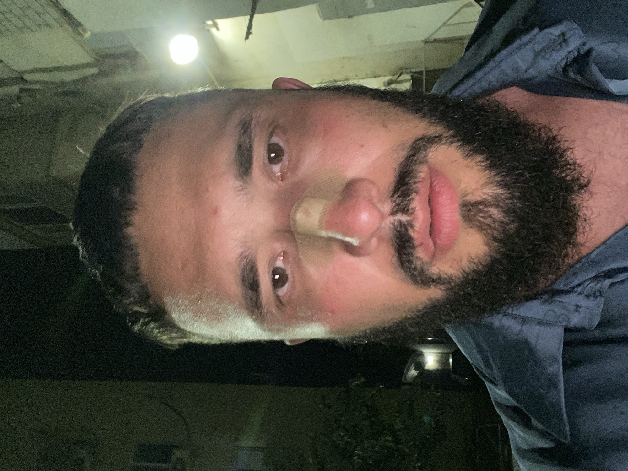 A man with a beard and short hair is shown from the chest up in a close-up selfie. He is wearing a dark blue shirt. A bandage is applied across the bridge of his nose. The background suggests an urban environment at night, with buildings and a light source visible. There is no clear indication of the specific location within Derbent, Russia.