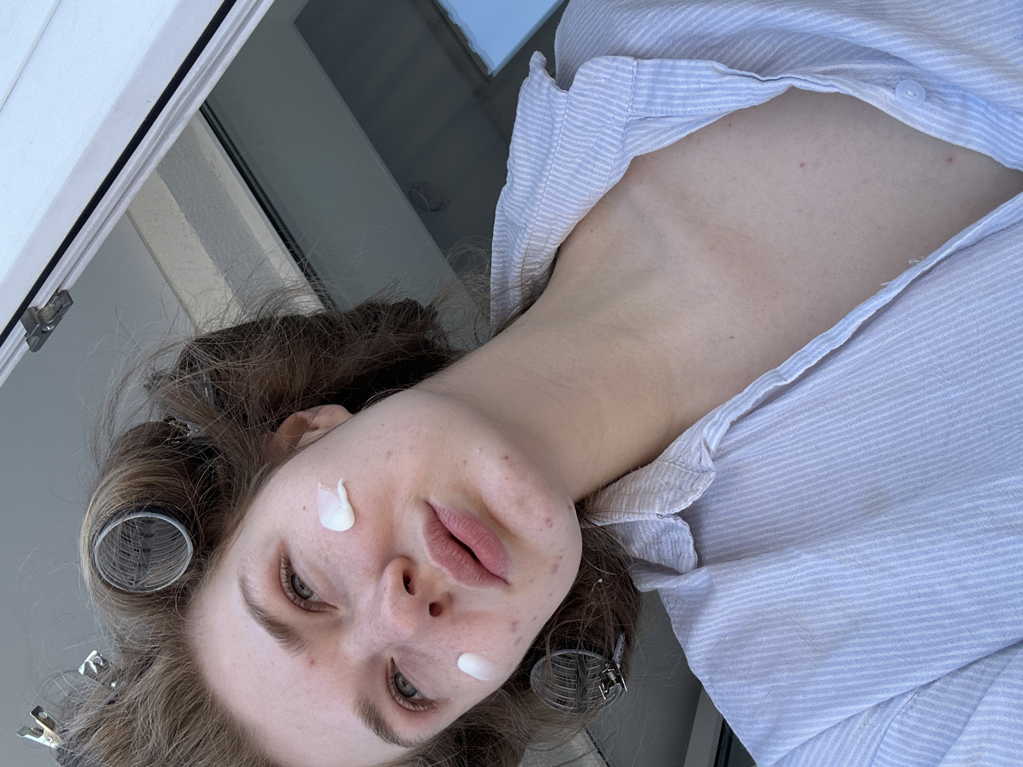 A woman is seen in a close-up, angled perspective. She has fair skin, brown hair in curlers, and a striped blue and white shirt. There are dabs of a white substance on her face. The background includes a window frame. There is no evidence to determine if the image was taken in Kazan, Russia.
