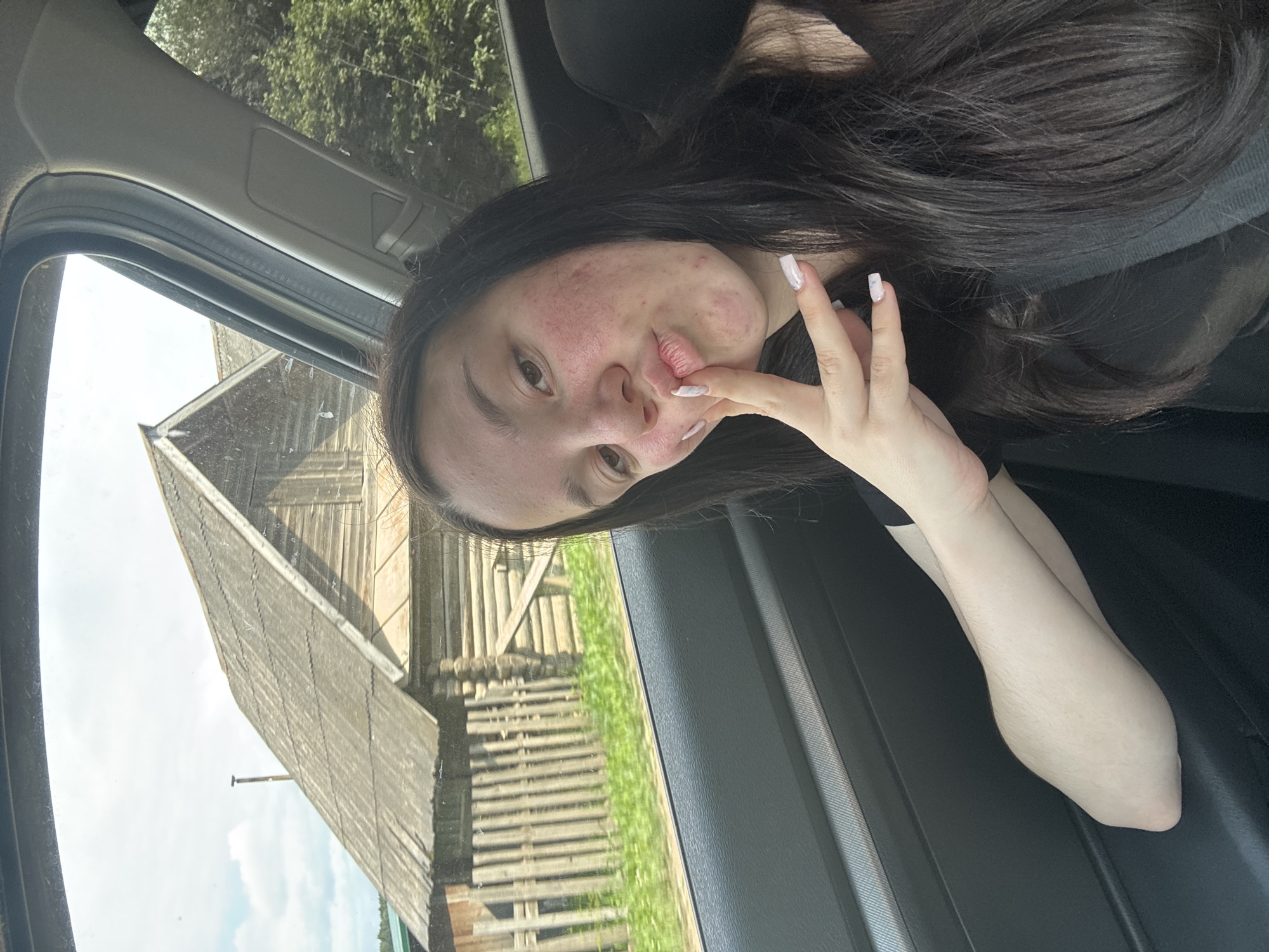 The image shows a young woman with dark hair inside a car, taking a selfie. She is wearing a black top. Her face is angled towards the camera, and she is making a pouty expression, with her index finger touching her lips. Her skin has visible blemishes and redness, particularly on her cheeks. She has long, dark hair that frames her face and extends to the right side of the frame. Her fingernails are painted with a light color, and she has a subtle nail art design.
Through the car window, a rustic wooden structure with a slanted roof is visible. The structure appears old and weathered, with visible wooden planks and supports. In the background, there is green grass and trees under a bright, cloudy sky, suggesting it is daytime. The overall scene has a rural feel. The orientation of the image is rotated, making the woman appear to be lying down.
The woman's expression and posture, combined with the indoor setting of the car, suggest a casual moment, perhaps during a car ride. The rural scenery outside the window provides a glimpse of the location. There is no visible text in the image.