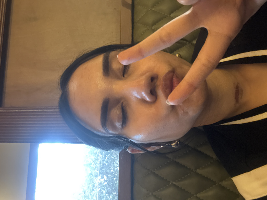 The image displays a close-up selfie of an adult female. She has dark hair, closed eyes, and her lips are pursed in a pouting gesture. Her left hand is raised, with the index and middle fingers forming a "peace" sign, positioned near her chin. A distinct horizontal scar is visible on the lower front of her neck. She wears dark attire, possibly a jacket, featuring white striped accents on the collar or lapel. An elongated earring is visible on her left ear, and a golden stud on her right ear. She is seated against a dark green, diamond-quilted upholstered backrest, typical of a booth in a restaurant or cafe. To her left, a window provides bright daylight, showing blurred outdoor foliage beyond. The window has a dark wooden frame and is bordered by vertical wooden paneling. A plain, light-brown wall occupies the upper right portion of the background. There are no discernible visual identifiers within the image itself to specify a precise location within Kolkata, India.