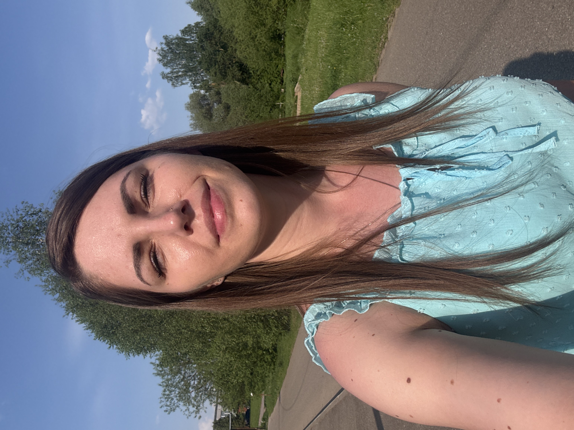 A woman with long, straight brown hair and fair skin is outdoors, likely standing on a paved path. She is wearing a light blue top with ruffled details. The background shows trees and a blue sky with some clouds, suggesting a park or green space. The scene is captured under bright sunlight. She has moles on her arm. The precise location in Shevlyakovo, Russia, cannot be determined from the image.