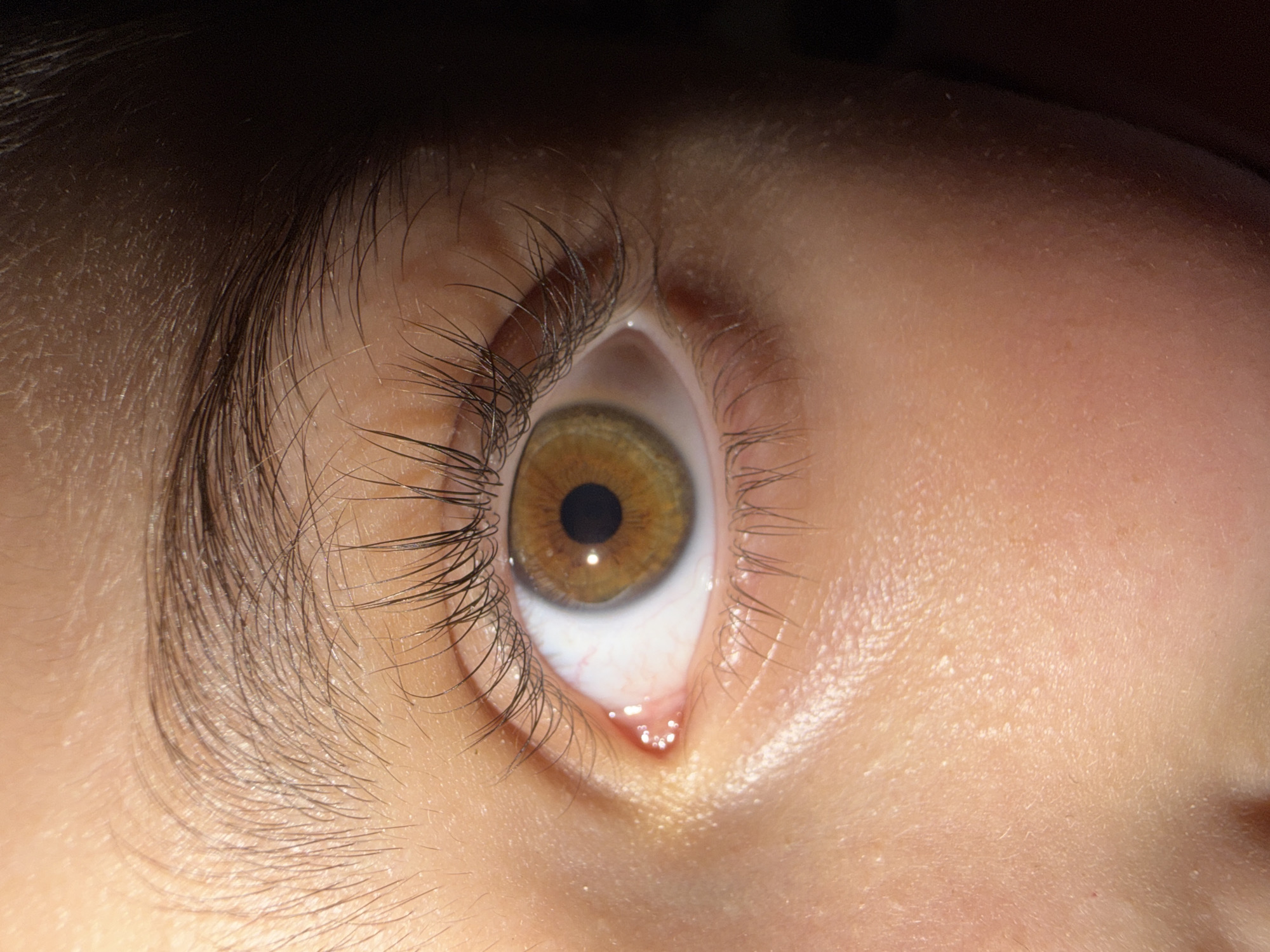 The image is a close-up of a human eye, with a portion of the eyebrow and surrounding skin visible. The eye is brown with a black pupil. The skin appears to be fair-skinned and has some texture. The lighting is dramatic, with one side of the face in bright light and the other in shadow. There is no indication of the location in Yerevan, Armenia, or any other geographical context. The image is a static shot and does not depict any actions or interactions.