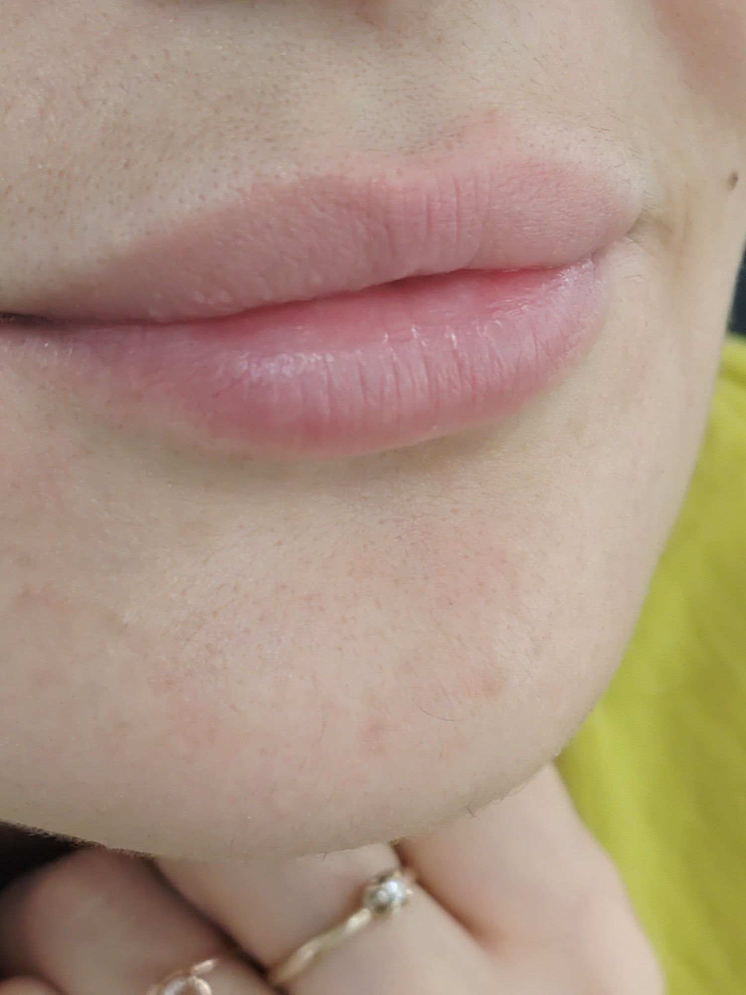 A close-up, eye-level shot shows the lower half of a person's face, focusing on their lips and chin. The lips are closed and appear slightly plump, with a subtle pink hue. The skin on the chin is fair and shows a few scattered pores and fine hairs. Two rings are visible on the person's finger, which is positioned in the lower right corner of the frame. One ring is a band with small, clear stones, and the other is a simple gold band. The background consists of a blurry expanse of yellow fabric.