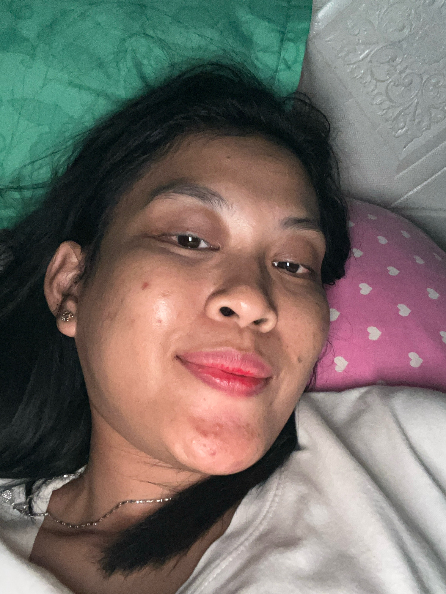A woman with dark hair and brown skin is lying down, her face filling the frame. She is wearing a white shirt and a thin silver necklace. Her lips are painted red, and there are some blemishes on her skin. To her left is a green pillow, and to her right is a pink pillow with white hearts. A white, textured surface is visible in the background. The scene appears to be an indoor setting, possibly a bedroom. The image does not provide specific details about the location within Kecamatan Pati, Indonesia.