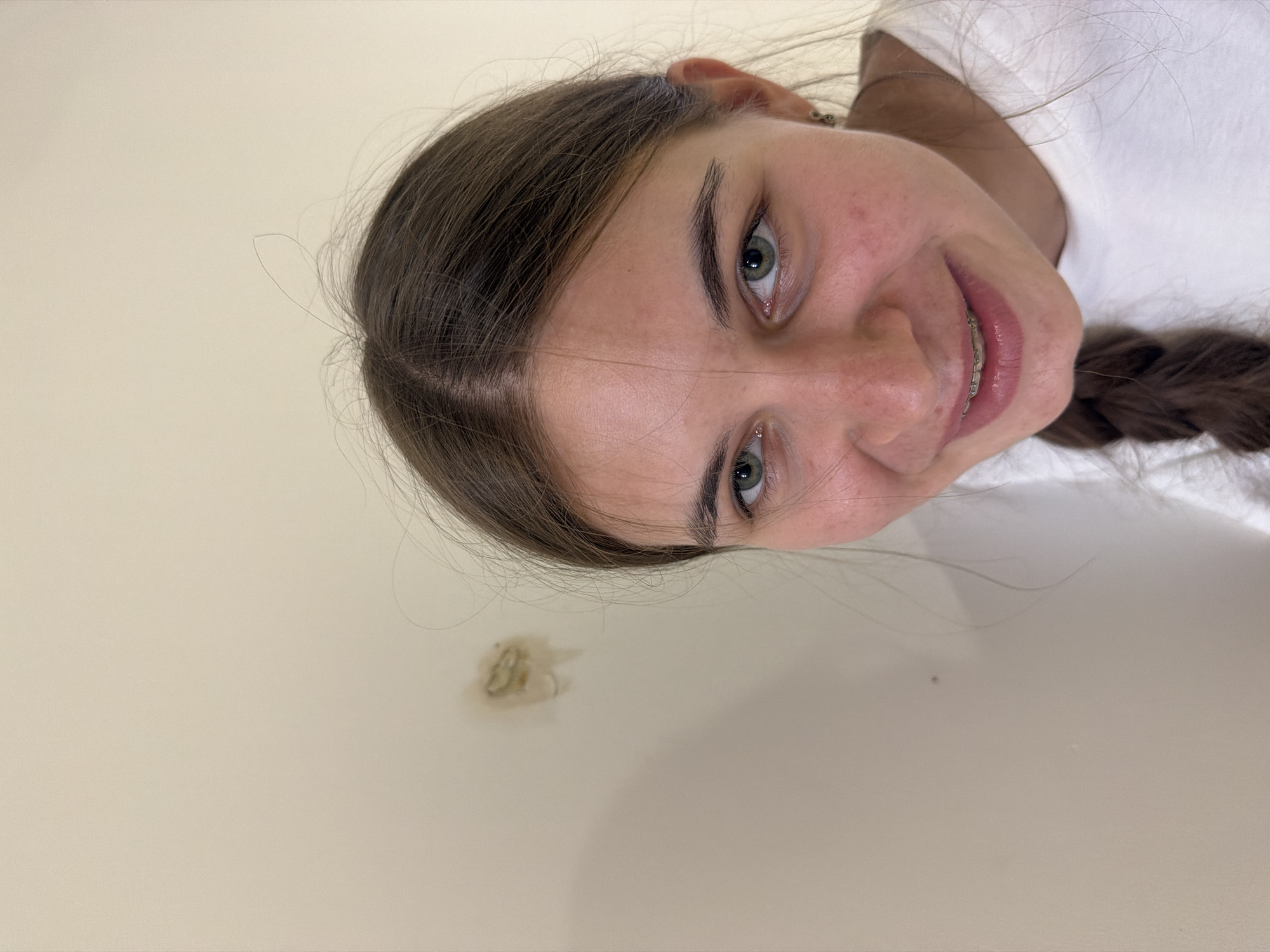 A young female with light brown hair and green eyes, wearing a white t-shirt and braces, looks directly at the camera. She has a slight smile and her hair is styled in a braid that falls over her shoulder. The background is a plain, light-colored wall with a small, discolored patch. The image appears to be taken indoors in a residential setting. There is no discernible information to suggest this scene is located in Nha Trang, Vietnam.