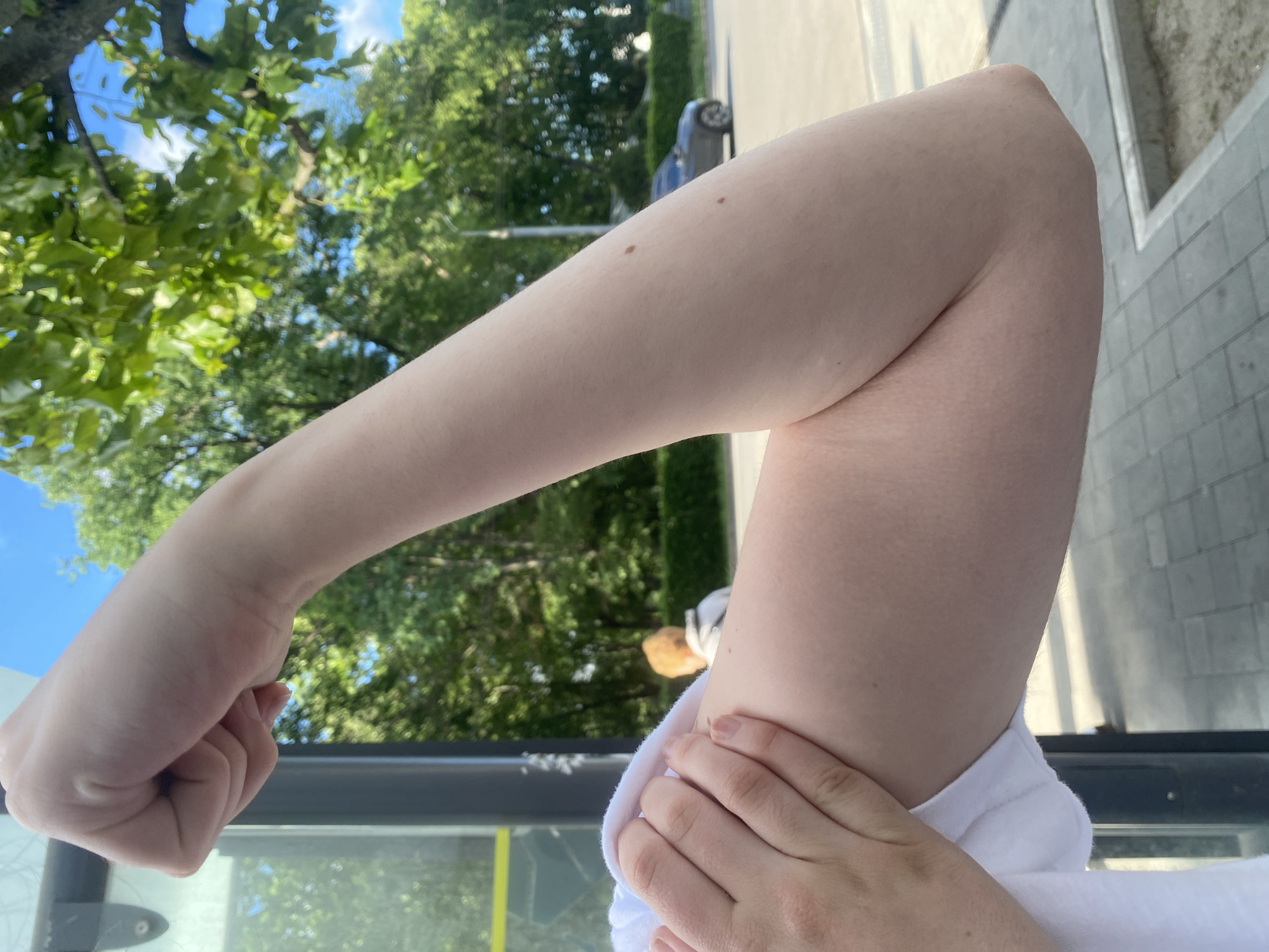 An arm, bent at the elbow and forming a fist, is in the foreground. The arm has pale skin and a few moles are visible. The person holding the arm is wearing a white garment. In the background, there are trees and blue sky visible through the trees. There is a sidewalk and a building on the right side of the frame. A car is parked in the background. This image was taken in Poltava, Ukraine.