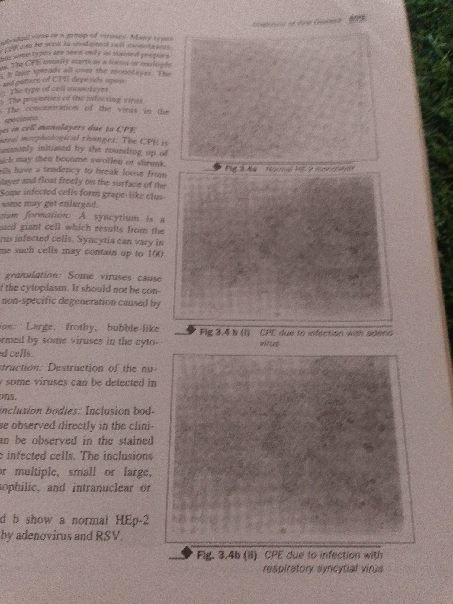 The image contains text and three micrograph images. The text discusses viral diseases and cytopathic effects (CPE). The micrograph images appear to show cell cultures. One image is labeled "Fig 3.4a Normal HE-2 monolayer". The other two images are labeled "Fig 3.4 b (i) CPE due to infection with adeno virus" and "Fig. 3.4b (ii) CPE due to infection with respiratory syncytial virus". The text and images are from a document related to virology and disease diagnosis. There is no information in the image that relates to the city of Jalingo, Nigeria.