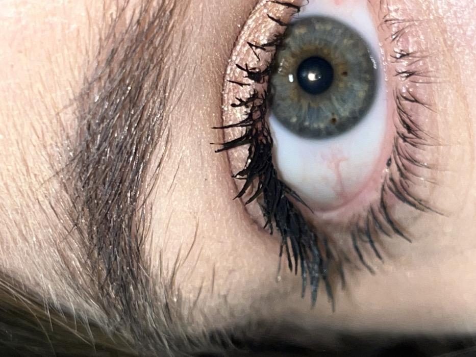 The scene is captured in the city of Zvonarevka, Russia. This image presents an extreme close-up of a human right eye and the surrounding facial features. The subject's eye exhibits an iris of greenish-blue coloration with distinct small brown flecks visible at approximately the 4 o'clock and 8 o'clock positions relative to the pupil. The pupil is black and reflects a single point of light, indicating a light source. The sclera is white, featuring several visible reddish capillaries, particularly prominent towards the nasal side. Both upper and lower eyelashes are coated with a dark substance, likely mascara, which appears somewhat clumpy on the upper lashes. The upper eyelid is adorned with a shimmery, light-colored eyeshadow, possibly rose gold or champagne, extending from the lash line towards the brow bone. A portion of a dark brown eyebrow, composed of individual hairs, is visible in the upper section of the frame. The skin surrounding the eye appears light-toned with visible pores and fine hair. No discernible action or interaction is present; the image is a static close-up.