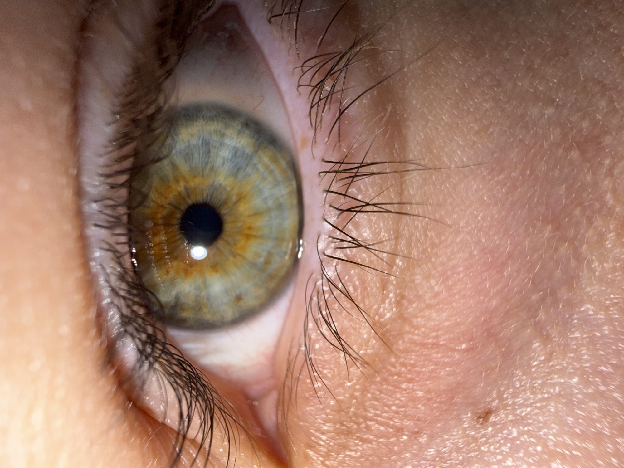 The image is a close-up view of a human eye. The iris is a mix of colors, including blue, green, and brown. The pupil is black and there is a white specular reflection on its surface. Eyelashes are visible surrounding the eye. The surrounding skin is fair.
There is no information in the image to indicate the location is Stara Zagora, Bulgaria.