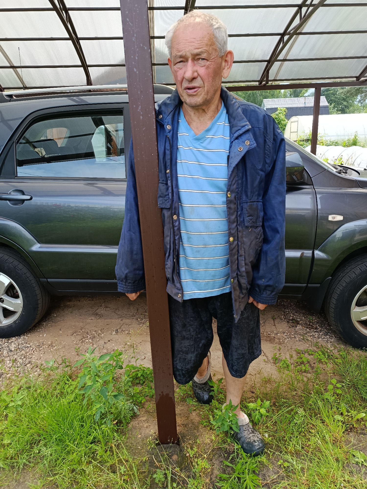 An elderly man with grey hair stands next to a dark grey SUV under a covered structure. He is wearing a blue horizontally striped t-shirt and a dark blue jacket, and dark shorts. His right leg is amputated below the knee and he is wearing a prosthetic. He is also wearing dark clogs on his feet. The ground is dirt and gravel, and there is green grass and vegetation around his feet. In the background, there are greenhouses and trees, suggesting a rural or suburban setting. The overall impression is one of a man in a casual outdoor environment.