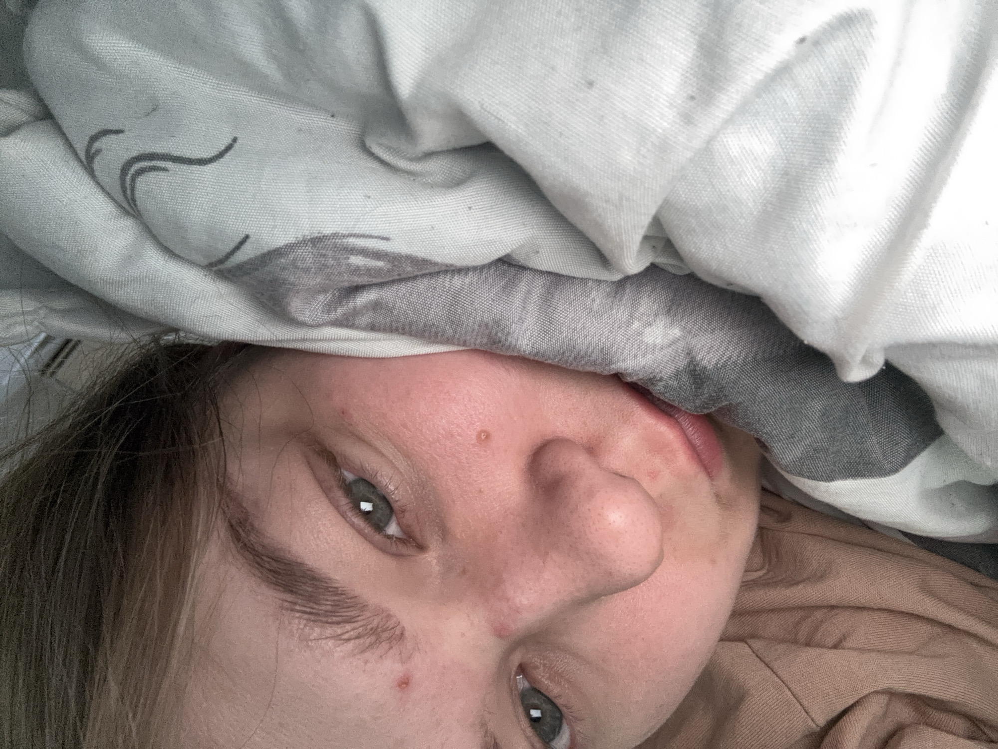 A close-up, upside-down view shows a person's face partially covered by a patterned bedsheet. The sheet is predominantly white and gray, with a faint, stylized design. The person's face is fair-skinned with visible pores and some minor blemishes. The person's eyes are open, and their lips are slightly parted. The person is wearing a light brown garment. The location is not discernible from the image.