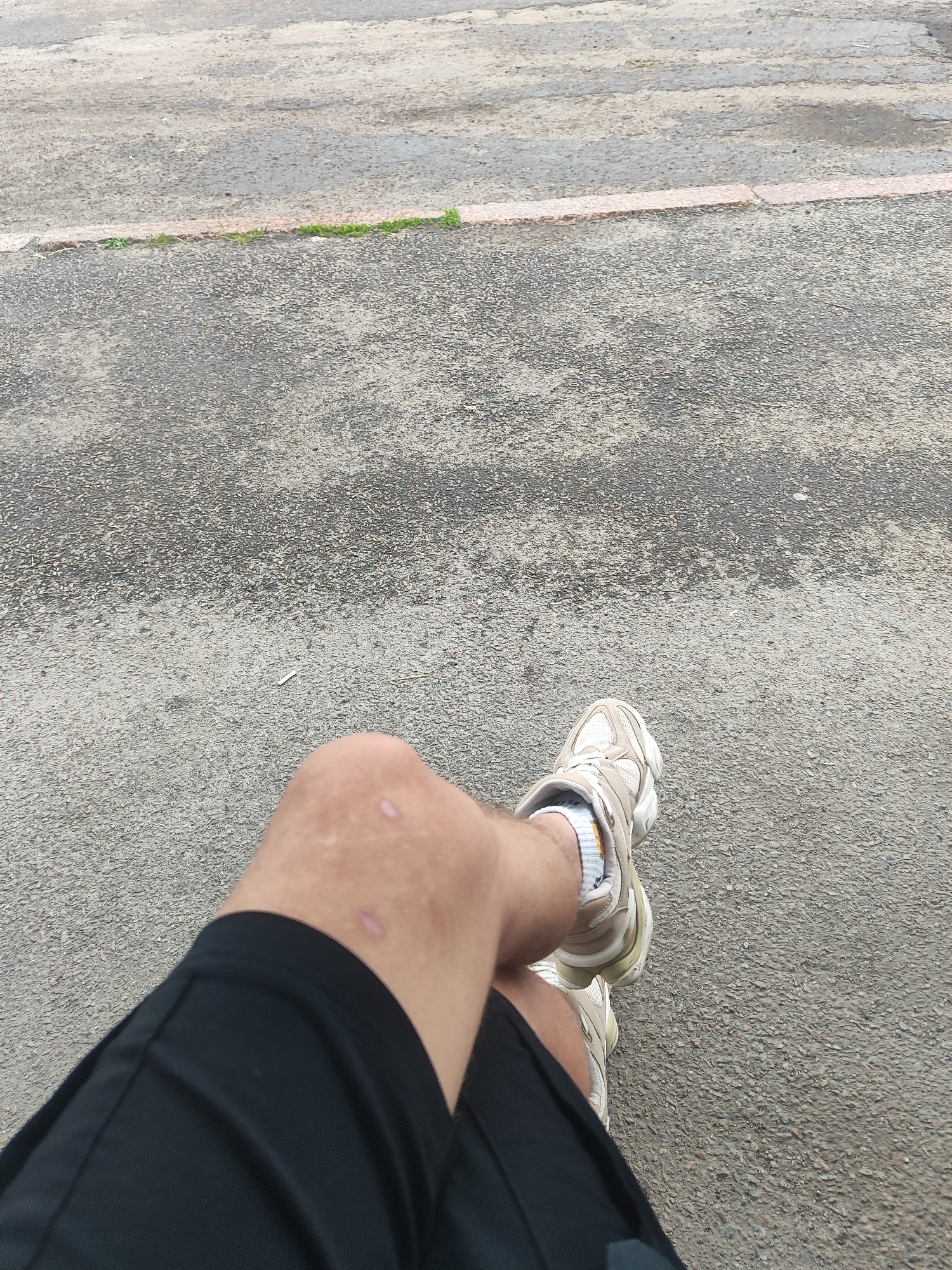 A low-angle, medium shot shows a person's legs and feet from the knees down, sitting on a paved surface. The person is wearing black shorts and beige athletic shoes with white socks. There are two noticeable scabs on the person's left knee. The ground appears to be asphalt with some scattered pebbles and a faint pink line running horizontally in the upper portion of the frame, with a thin strip of green grass growing above it. The lighting suggests it is daytime, and the weather appears to be overcast or the sun is not directly visible, as there are no strong shadows. The scene is likely outdoors, possibly a park, sidewalk, or recreational area. The overall mood is neutral, with no strong emotional cues present. There is no visible text in the image. The location context is Shamraivka, Ukraine.