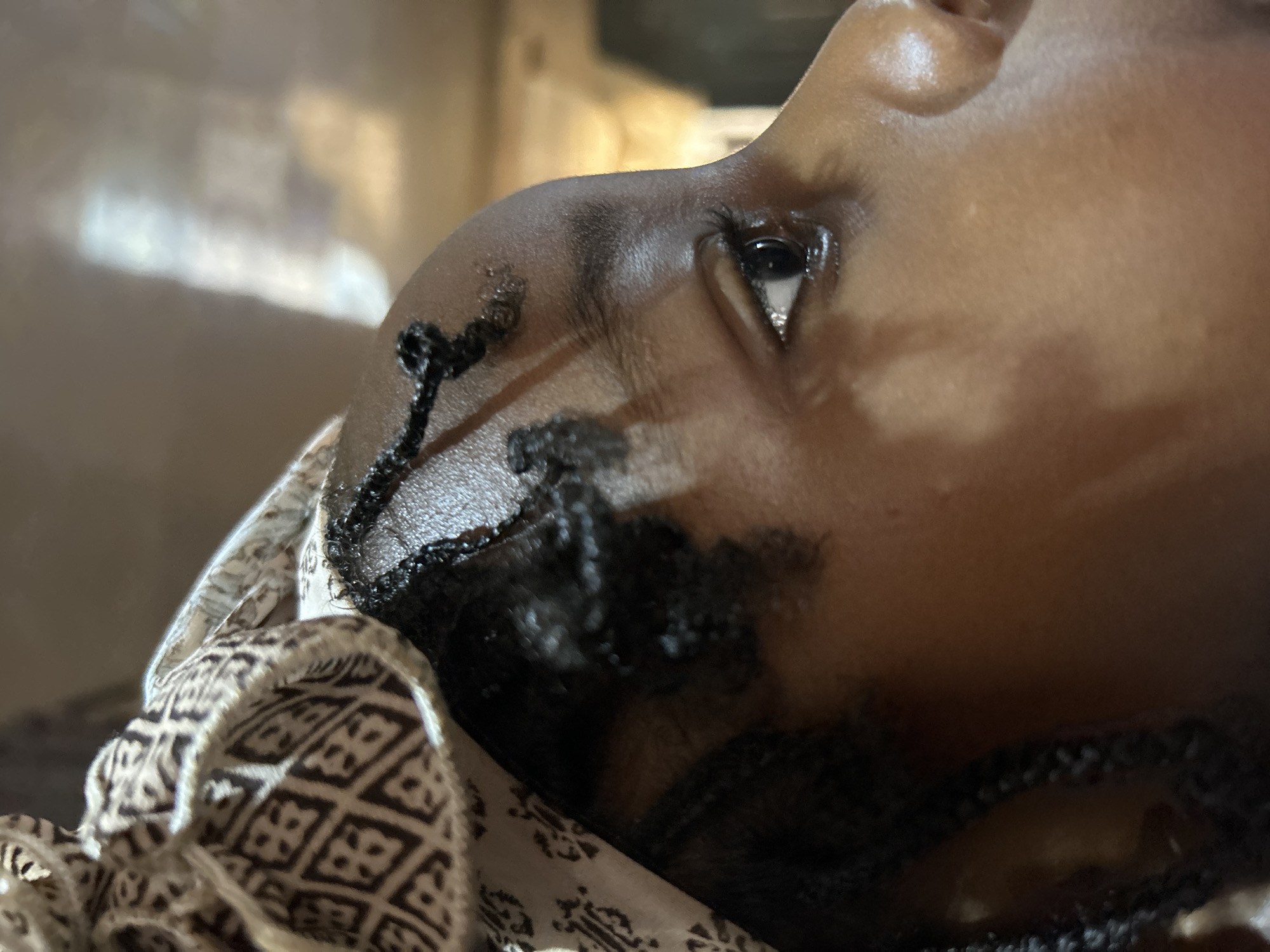 A close-up, low-angle shot depicts a person's face resting against a patterned fabric. The individual has dark skin and intricate braids, some arranged near the forehead and cheek. The visible eye is dark, with a bright reflection on the cornea. The background is blurred and indistinct. The location in the city of Jos, Nigeria is not discernible from the image.
