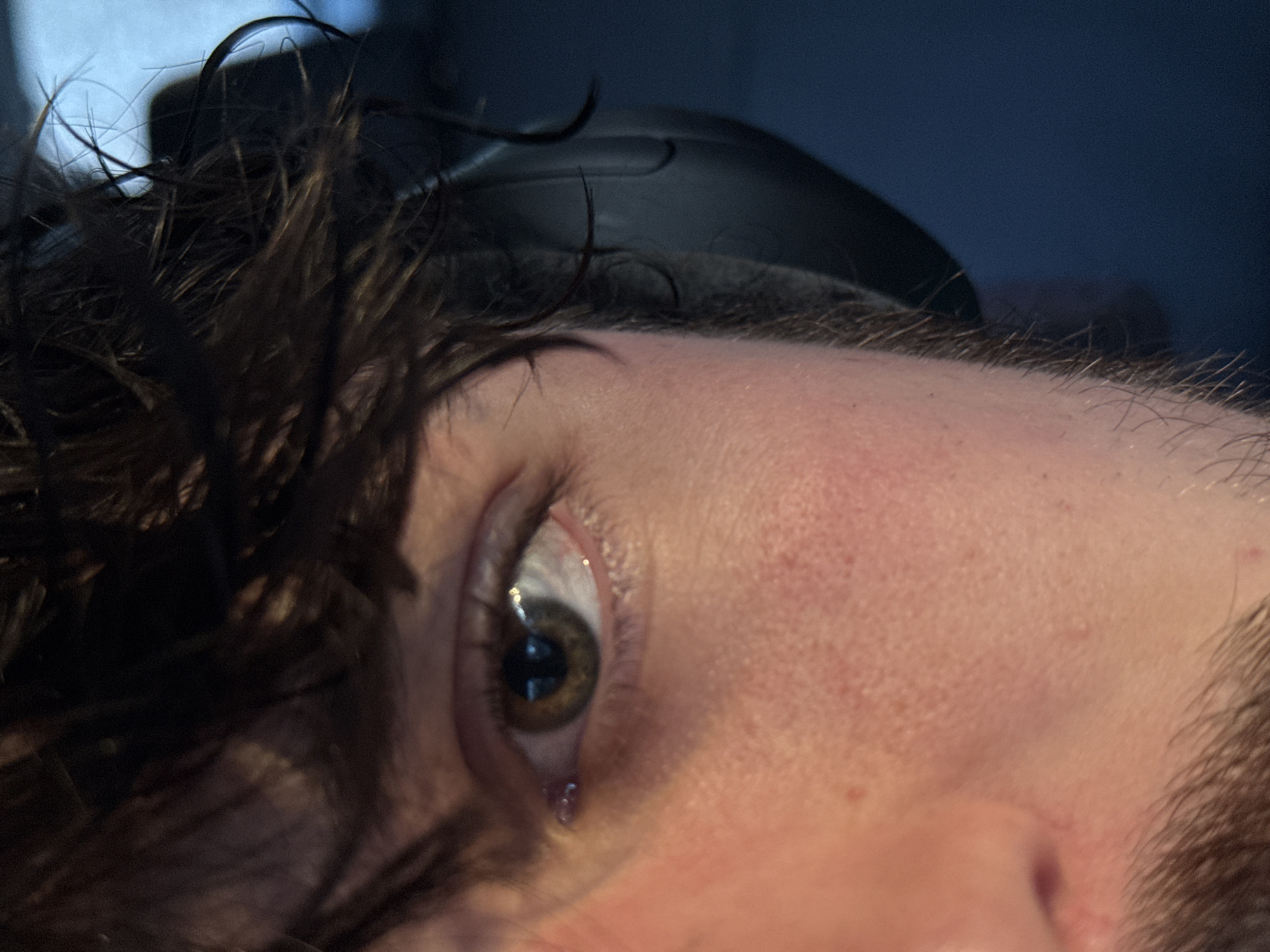 A close-up, tilted image focuses on a person's eye and adjacent facial features. The individual has brown hair, with strands partially obscuring the eye. The eye is hazel or brown, with a visible tear or droplet at the lower lid. The skin is fair, showing some redness on the cheek. Above the eyebrow, sparse brow hairs are visible. In the background, out of focus, is a black object resting against the individual's head, possibly a headphone or other accessory. The setting and location are unclear.