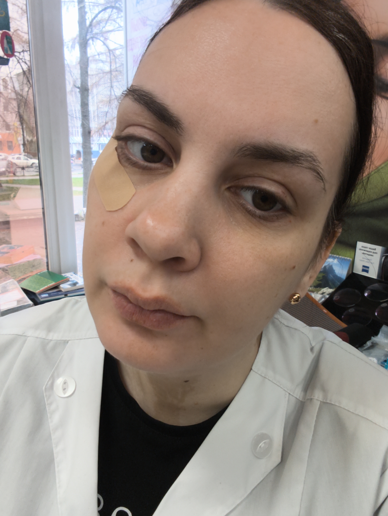 A close-up, slightly tilted portrait captures a woman indoors, likely in an optometry office in Chaikovsky, Russia. She has dark hair pulled back, dark brown eyes, and a neutral, somewhat serious expression, looking directly at the camera. A light-colored adhesive bandage is prominently placed on her left temple/cheekbone area, near her eye. She is wearing a white lab coat over a black t-shirt, with a clear plastic button visible on her lapel. A small gold stud earring adorns her right earlobe.
Through a large window behind her, bare trees and a street scene are visible, suggesting late autumn or winter weather conditions outside. The indoor setting includes various items on a desk near the window, such as books. To her right, behind her shoulder, optical display items are visible, including a box with the "ZEISS" logo. Cyrillic text on this display reads "НОВЫЙ МИР" (NEW WORLD), "КАЖДЫЙ ДЕНЬ" (EVERY DAY), and "с очками для хорошего зрения" (with glasses for good vision), confirming the setting as an optical or eyecare establishment. The natural light from the window indicates it is daytime.