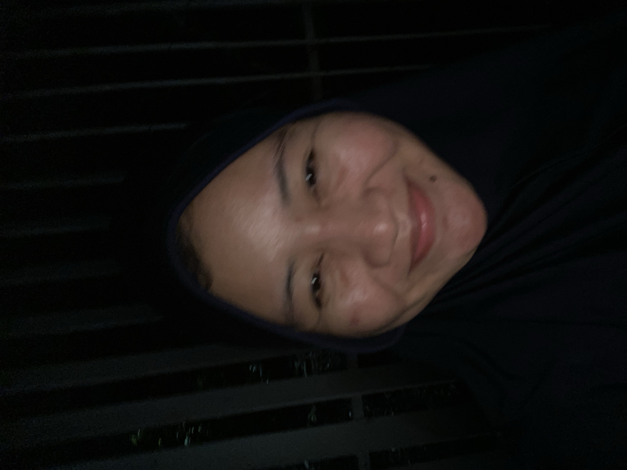 The image is a close-up, poorly lit selfie of a woman wearing a dark hijab. Her face is the primary subject, with visible skin texture and some blemishes or redness on her cheeks. She is smiling, with her mouth slightly open. The background consists of dark, vertical bars, suggesting a fence or railing, possibly outside. The overall impression is that the photo was taken at night or in a very dark environment. There is no discernible information in the image to indicate a specific location within Banjarbaru, Indonesia.