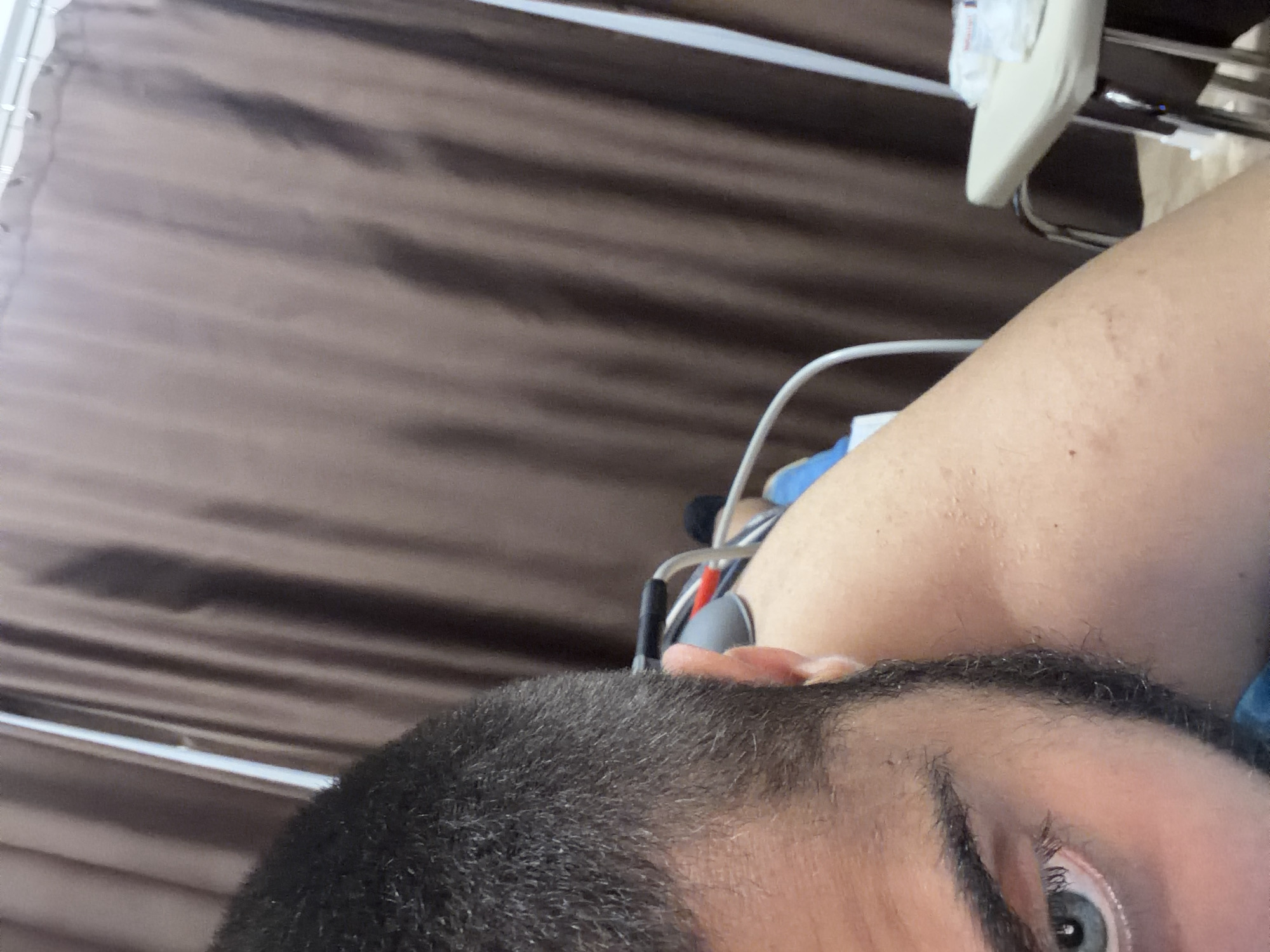 This close-up, angled image captures a person's head and upper body, seen from a side perspective. The subject is primarily the right side of a person's face, featuring a blue/grey eye, a dark eyebrow, and short, dark hair or stubble on the head and possibly a beard along the jawline. Part of their right ear is visible, along with a portion of their bare arm and shoulder, which shows some minor skin marks or imperfections.
In the background, a patterned surface resembling vertical striped curtains or blinds in shades of dark and lighter brown is visible. Several white and grey cables or wires snake around the person's shoulder and head area, with one prominent white cable looping in the mid-ground. To the upper right, partially obscured by the person's arm, appears to be medical equipment: a light-colored support structure and a clear plastic bag or container hanging, indicative of an IV drip or similar medical apparatus. A metallic frame, possibly part of a chair or bed, can also be seen.
The scene suggests an indoor setting, most likely a medical environment such as a hospital room or clinic, due to the visible equipment. The person appears to be resting or reclining, with a neutral expression. There is no specific activity taking place beyond their presence in the setting. No visible text is present in the image.