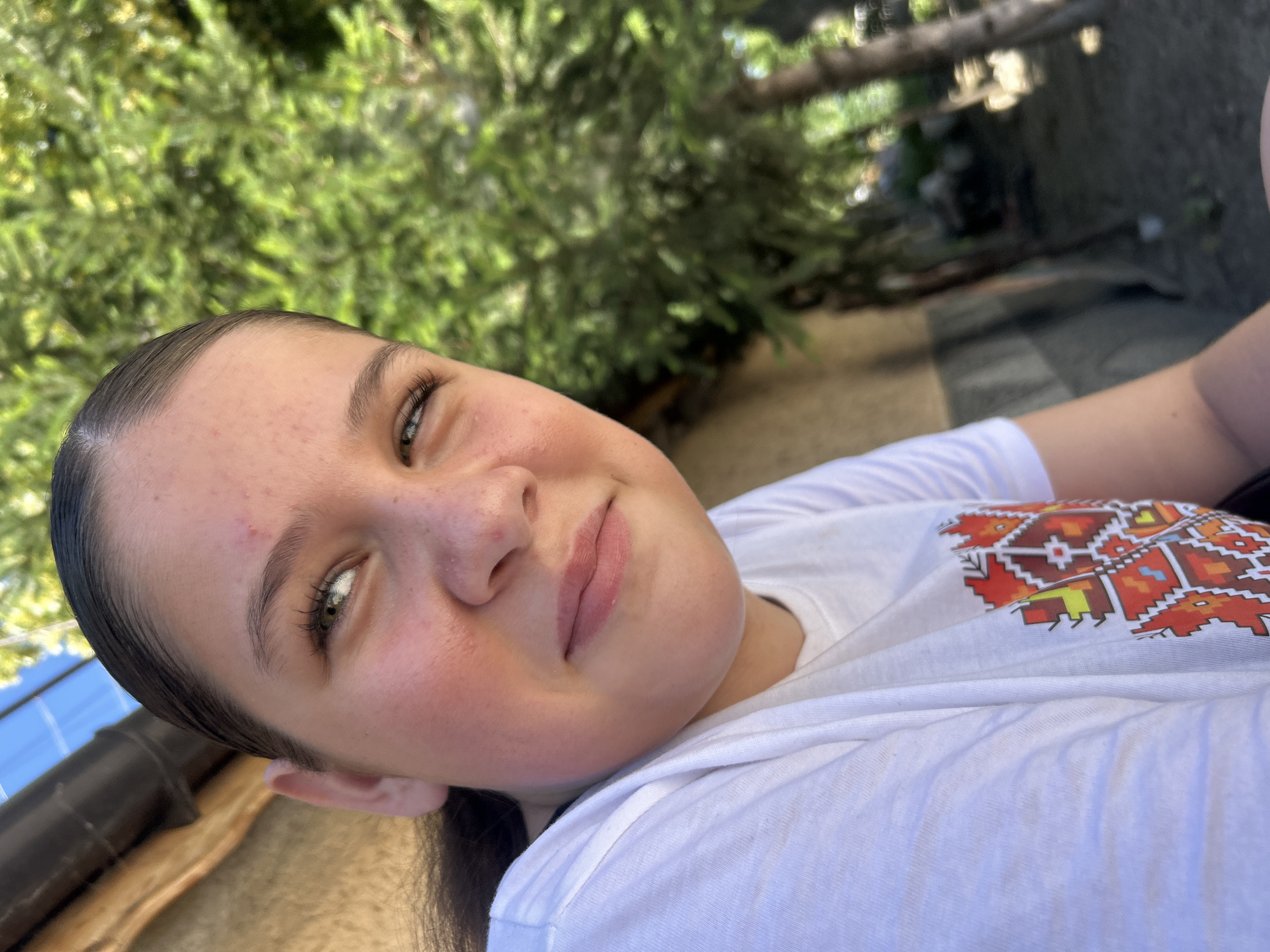 A young girl, with dark hair pulled back and green eyes, looks to her right. She is wearing a white t-shirt with a colorful, geometric pattern on the chest. Her skin is slightly flushed, and there is a small red mark on her forehead. The background is blurred, showing foliage and a rustic building. The scene is outdoors, likely in the village of Govedare, Bulgaria, given the natural elements and architectural style.