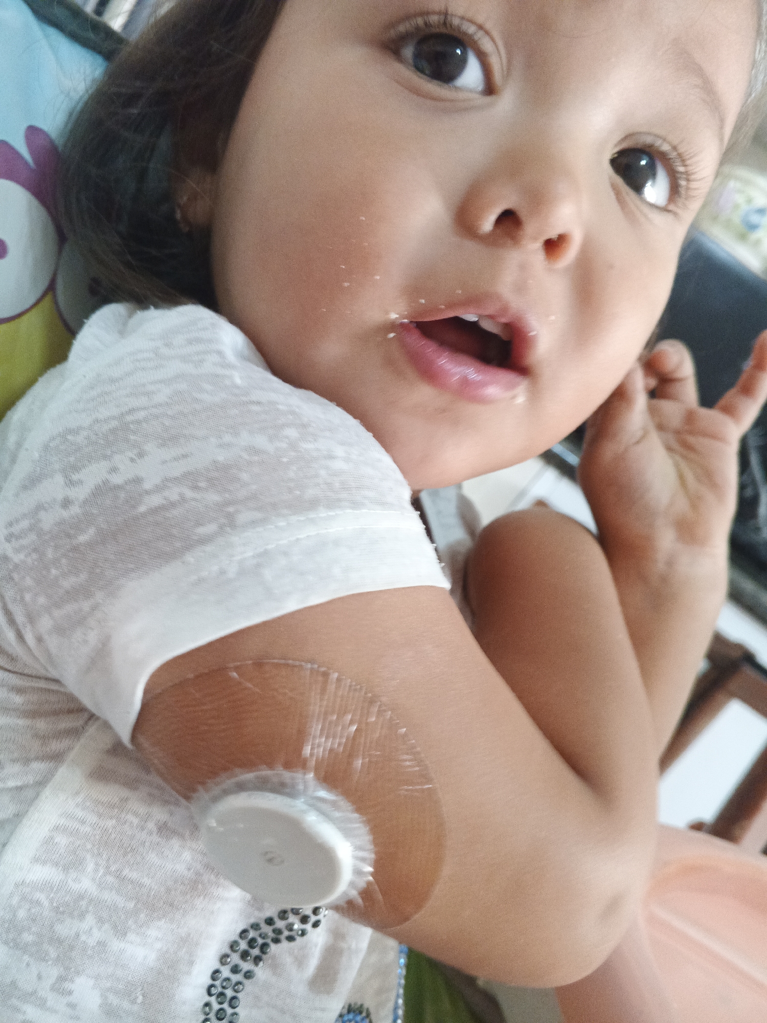The image presents a close-up, slightly tilted portrait of a young child, likely a toddler, looking towards the viewer with wide, dark, and expressive eyes. The child's mouth is slightly open, revealing small teeth, and there are small white specks, possibly food particles, around the lips and on the left cheek. The child has fair skin and dark hair, visible around the ear.
A prominent object is a white, circular medical device, appearing to be a continuous glucose monitor (CGM) or similar sensor, adhered to the child's left upper arm with a clear, flexible patch. The child is wearing a white t-shirt with a subtle, textured pattern and a small cluster of dark, possibly embellished, dots near the bottom left edge of the frame. The child's right hand is partially visible in the lower right corner, slightly raised.
The scene appears to be indoors, with a softly blurred background showing hints of colorful fabric (possibly a pillow or blanket) on the left and indistinct shapes on the right. The child's expression is one of curiosity or surprise, captured in a candid moment, perhaps during or after a snack. The medical device suggests the child is managing a health condition, such as diabetes. No clear, legible text is visible on the device or elsewhere in the image. The provided context indicates the location is Caracas, Venezuela.