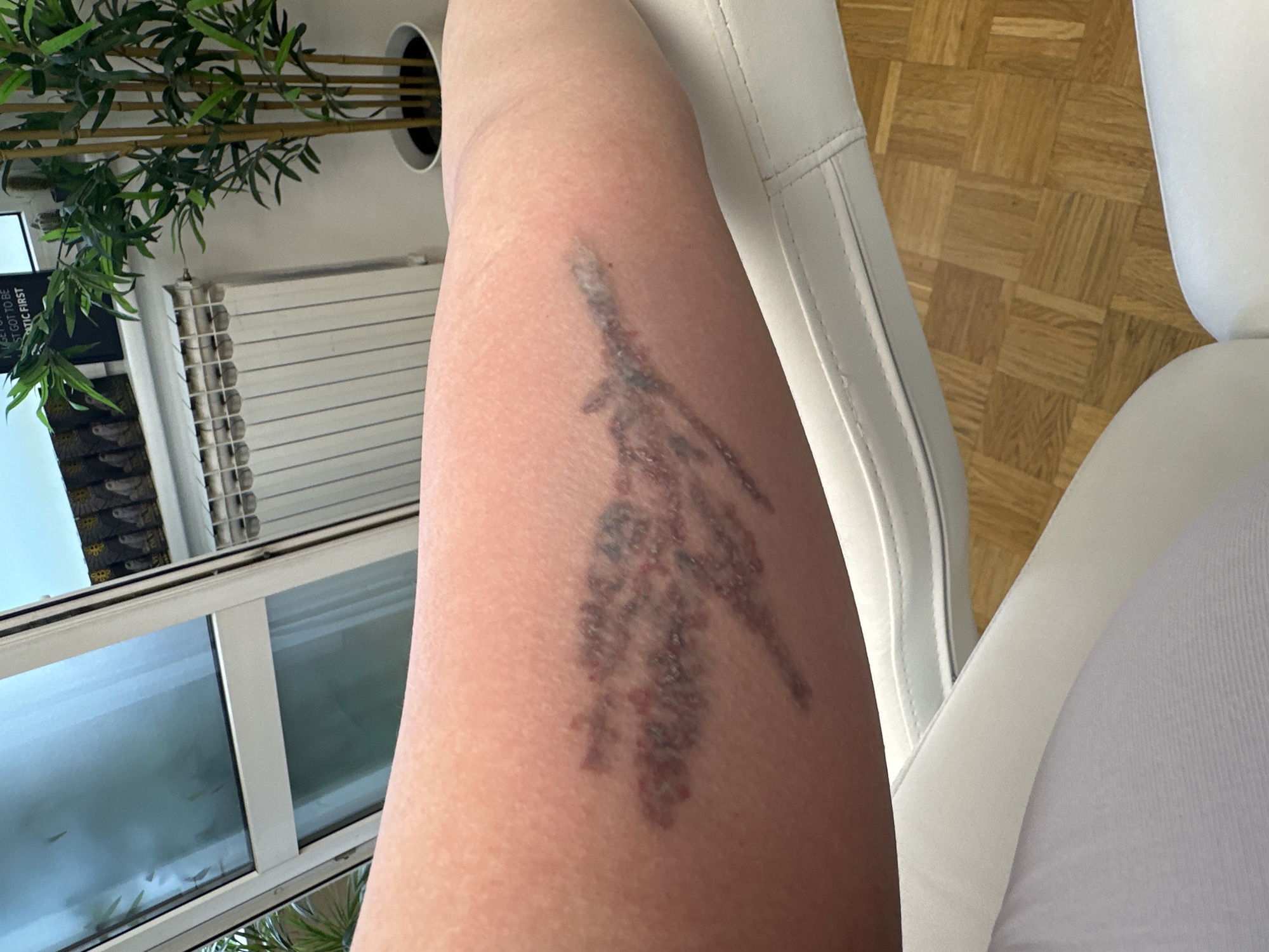 The image primarily features a close-up of a person's bare leg, likely a thigh or upper calf, positioned diagonally across the frame. The skin is fair. A prominent, dark, and irregularly shaped marking, resembling a large tattoo or a skin condition, is visible on the leg. This marking shows signs of activity, with areas of redness and raised texture, suggesting it may be new, healing, or irritated. The pattern of the marking is abstract, with branching or fragmented elements.
The person appears to be seated, with a portion of a white chair or seat visible on the right side of the frame. The setting is indoors, with natural light entering from a large window or glass door in the background. A tall potted plant with green leaves and thin stems (resembling bamboo) is seen on the left. Below the plant is a white radiator against a white wall. The floor features a wooden parquet or block pattern. A patterned blind or curtain is partially visible above the window. Through the window, faint, rotated text fragments like "ST GOT TO BE" and "ATIC FIRST" can be seen on what appears to be a screen or sign. The bright illumination suggests it is daytime. No specific activity beyond sitting is depicted, and no emotions are discernible. The location context is the city of Zagreb, Croatia.