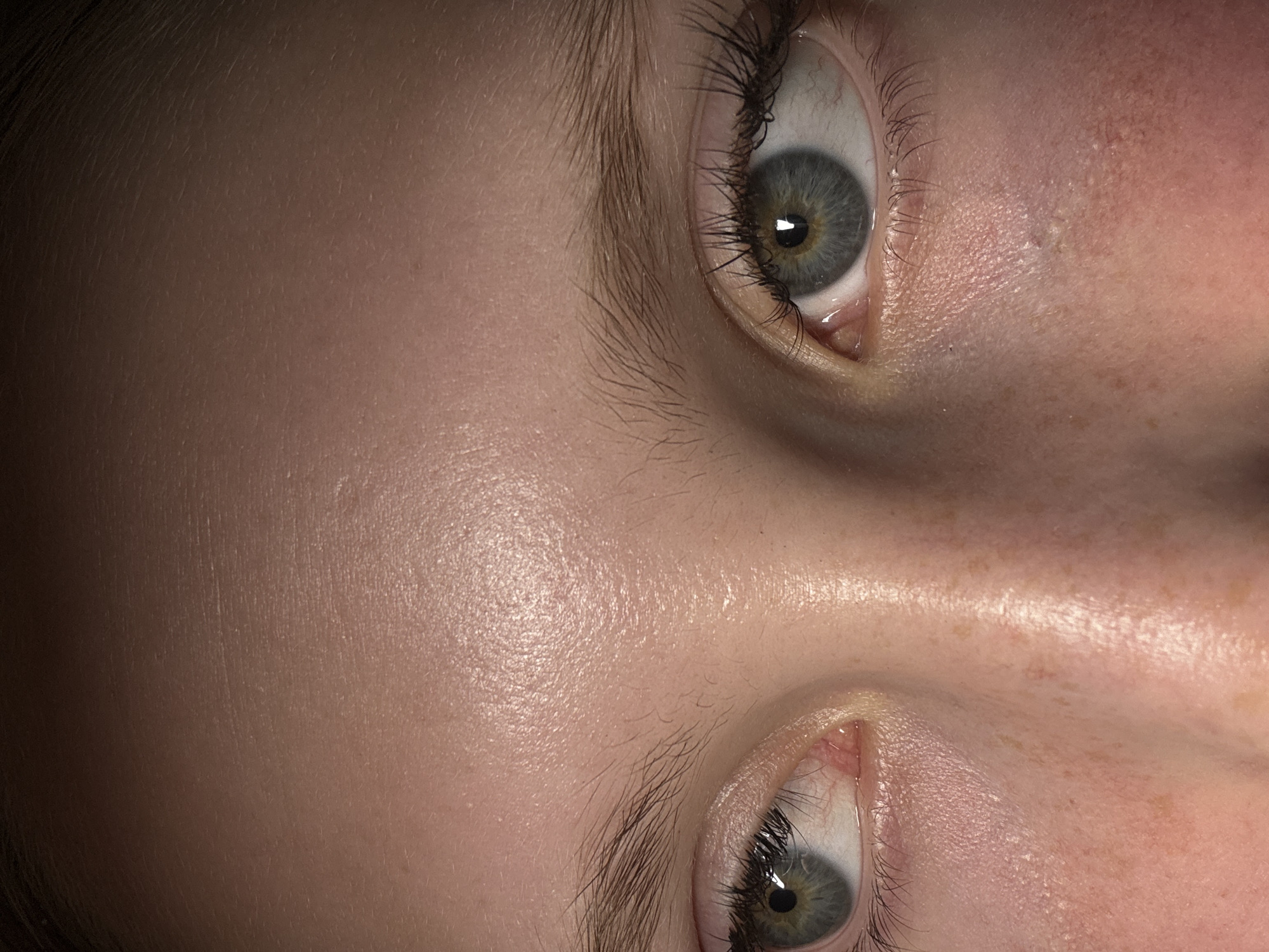 The image is a close-up shot of a person's face, specifically focusing on their eyes and the surrounding skin. Two eyes are visible, one positioned above the other, both with long eyelashes and grey irises. The skin around the eyes appears light-toned, with some visible freckles or blemishes in areas. The skin texture suggests a slightly oily surface. The image is taken from a close proximity, blurring the background and emphasizing the details of the eyes and skin. There is no indication of the location in the city of Chaikovsky, Russia.