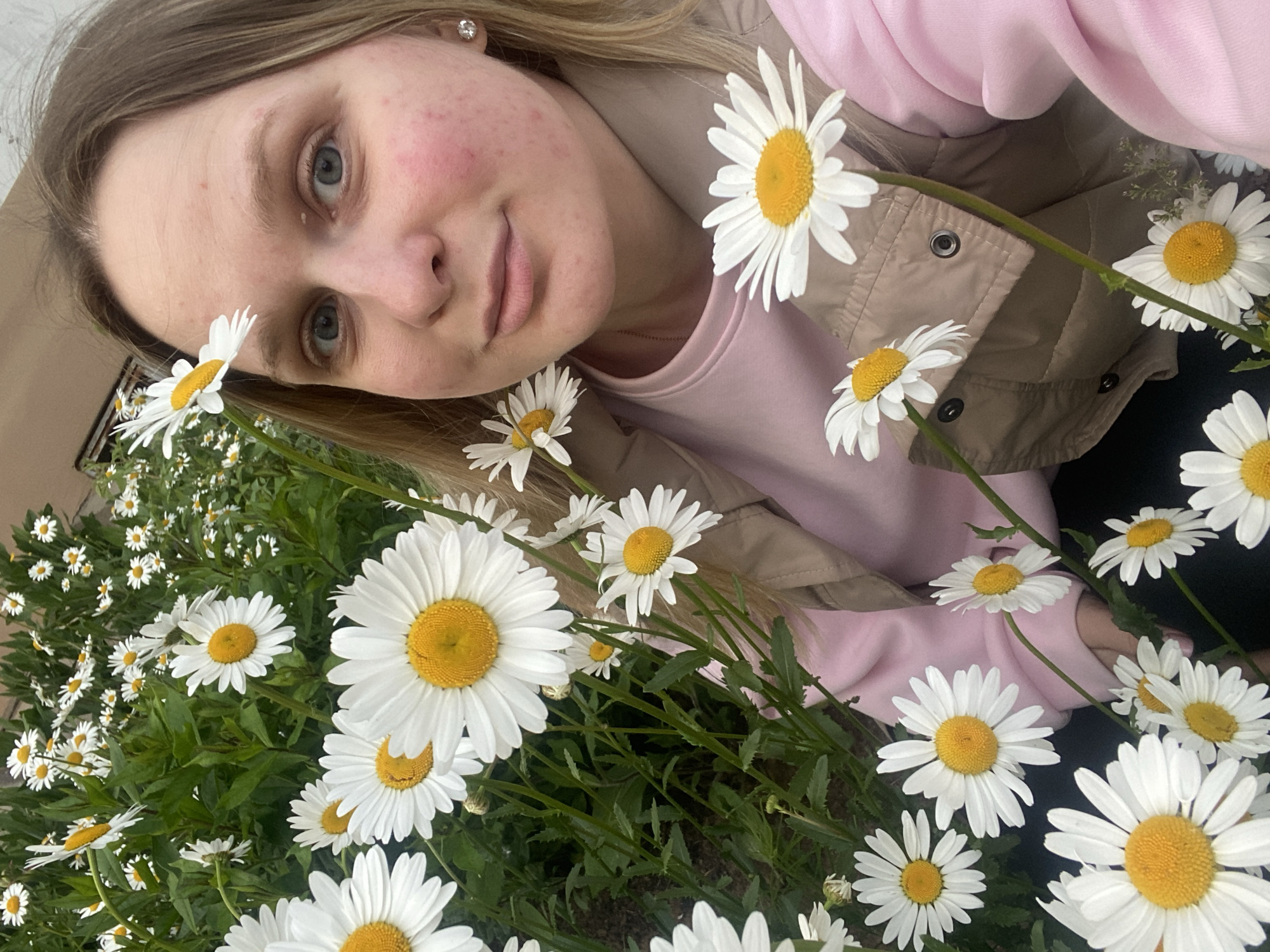 A candid, eye-level portrait depicts a young adult female amidst a dense cluster of white daisies with yellow centers. The individual, possessing light skin, light brown hair, and blue eyes, looks directly towards the viewer with a slight smile. Redness and small blemishes are visible on her cheeks. She wears a light pink long-sleeved shirt and a beige quilted vest. A silver stud earring is present in her right earlobe. Numerous daisies surround her, with several prominent in the foreground and some appearing to be held near her face and clothing. The background consists of green foliage and a blurred light-colored building structure in the upper right. The scene is illuminated by natural daylight in the city of Unknown, Unknown.