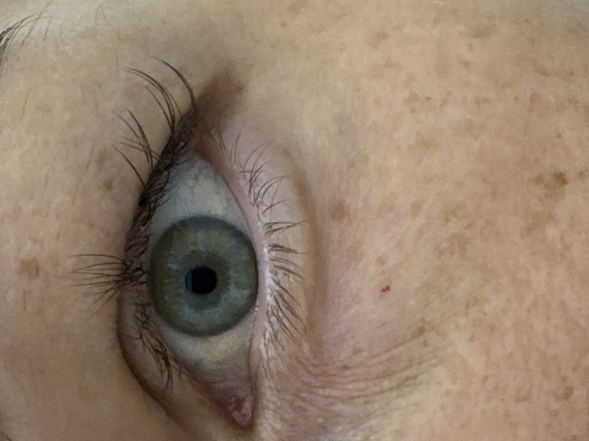 This is an extreme close-up, eye-level shot of a human eye and surrounding skin. The eye is open, revealing a green iris with a dark pupil. Eyelashes are visible above and below the eye, some appearing slightly smudged. The skin shows texture with fine lines, particularly under the eye, and a scattering of freckles and some minor blemishes, including a small red mark. The lighting appears to be natural and soft, highlighting the details of the skin and eye. The image is a tight crop, with no environmental context provided beyond the immediate facial features. The location of Chaikovsky, Russia is not depicted in this image.