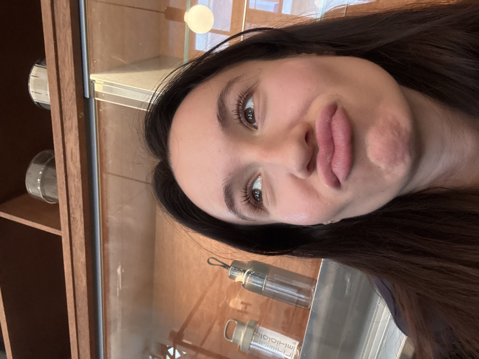 A single female subject is depicted in a close-up, selfie-style photograph within an indoor commercial establishment in Tel-Aviv, Israel. The subject, positioned centrally, presents a pouting expression with pursed lips and eyes directed upwards and slightly to the right. Her dark brown hair frames her face.
The background consists of a modern retail display. A wooden shelf runs horizontally across the upper portion of the frame, underneath which is a clear glass display case. Inside the lower section of the case, two distinct clear cylindrical bottles are visible on a reflective surface. The bottle on the left displays vertical text, partially decipherable as "BIOTIN," and has a light-colored loop handle integrated into its cap. The bottle to its right is taller and narrower, featuring a metallic-toned cap with a similar loop. On the wooden shelf above the glass display, two additional transparent, lidded containers are present. A spherical white light fixture is visible in the upper right background, reflecting in the glass. The environment suggests a clean, modern aesthetic, consistent with a health-focused cafe, juice bar, or wellness product store.