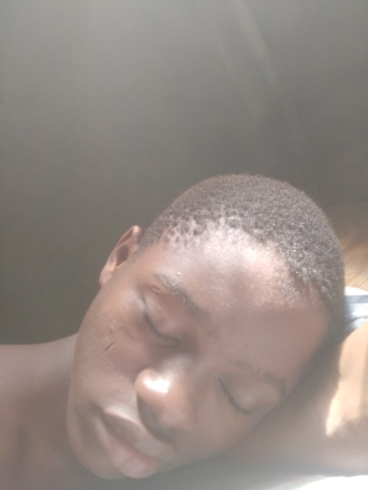 A close-up, high-angle shot depicts a young Black male asleep. His head is resting on what appears to be a pillow or cushioned surface. He has short, dark hair, closed eyes, and visible scarring on his face. The lighting in the image is bright, potentially from natural sunlight, causing glare. The background is out of focus. There are no indicators to pinpoint the specific city location or provide further detail beyond the individual subject.