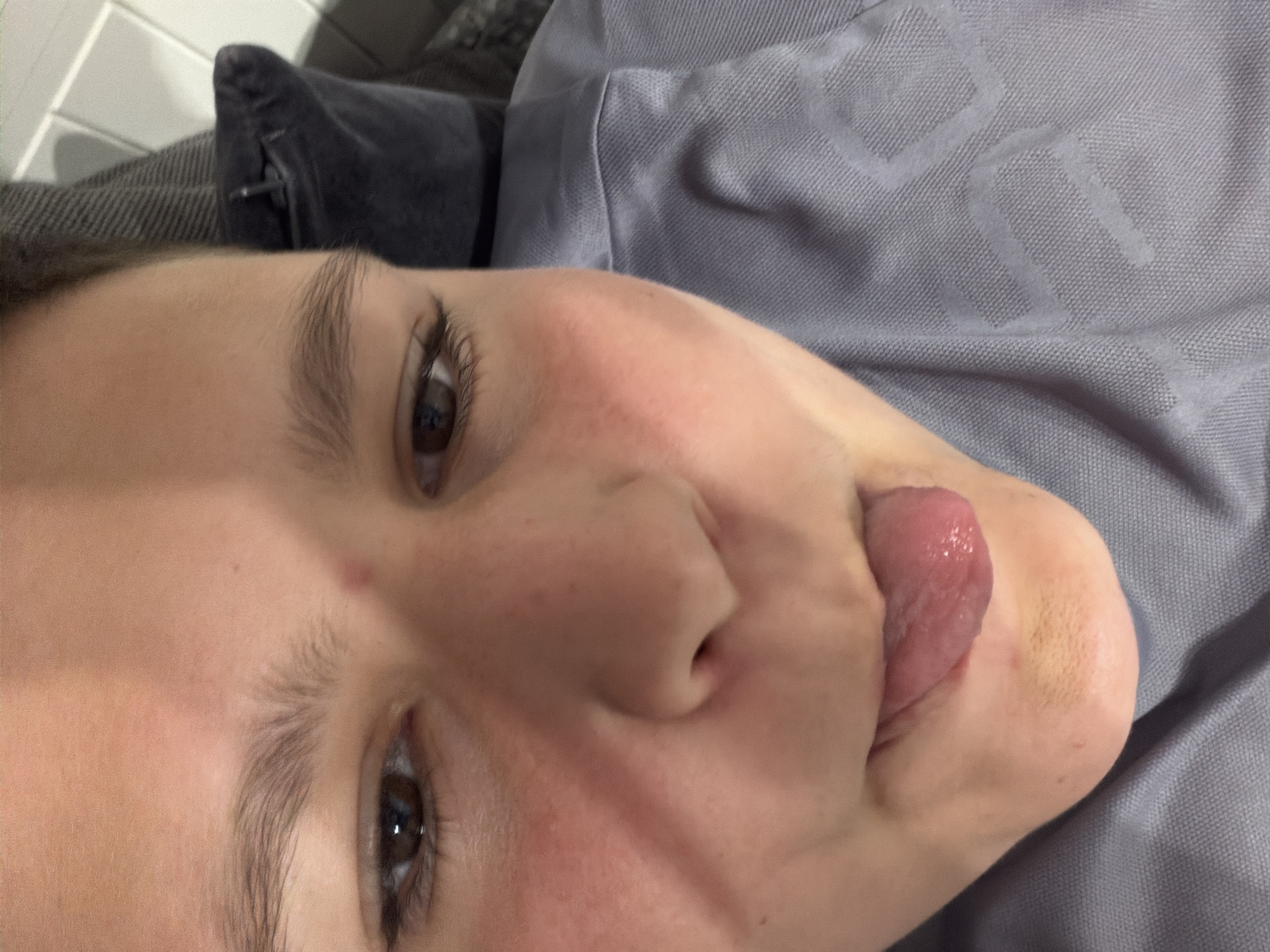 A close-up, tilted, eye-level shot shows a person's face with their tongue sticking out. The person has fair skin, brown eyes, and eyebrows. There is a small mole on their forehead and redness on their cheeks. The background is a gray fabric, possibly clothing or bedding, with a repeating pattern. The setting is indoors. The image does not include specific indicators to suggest the location in Sofia, Bulgaria.