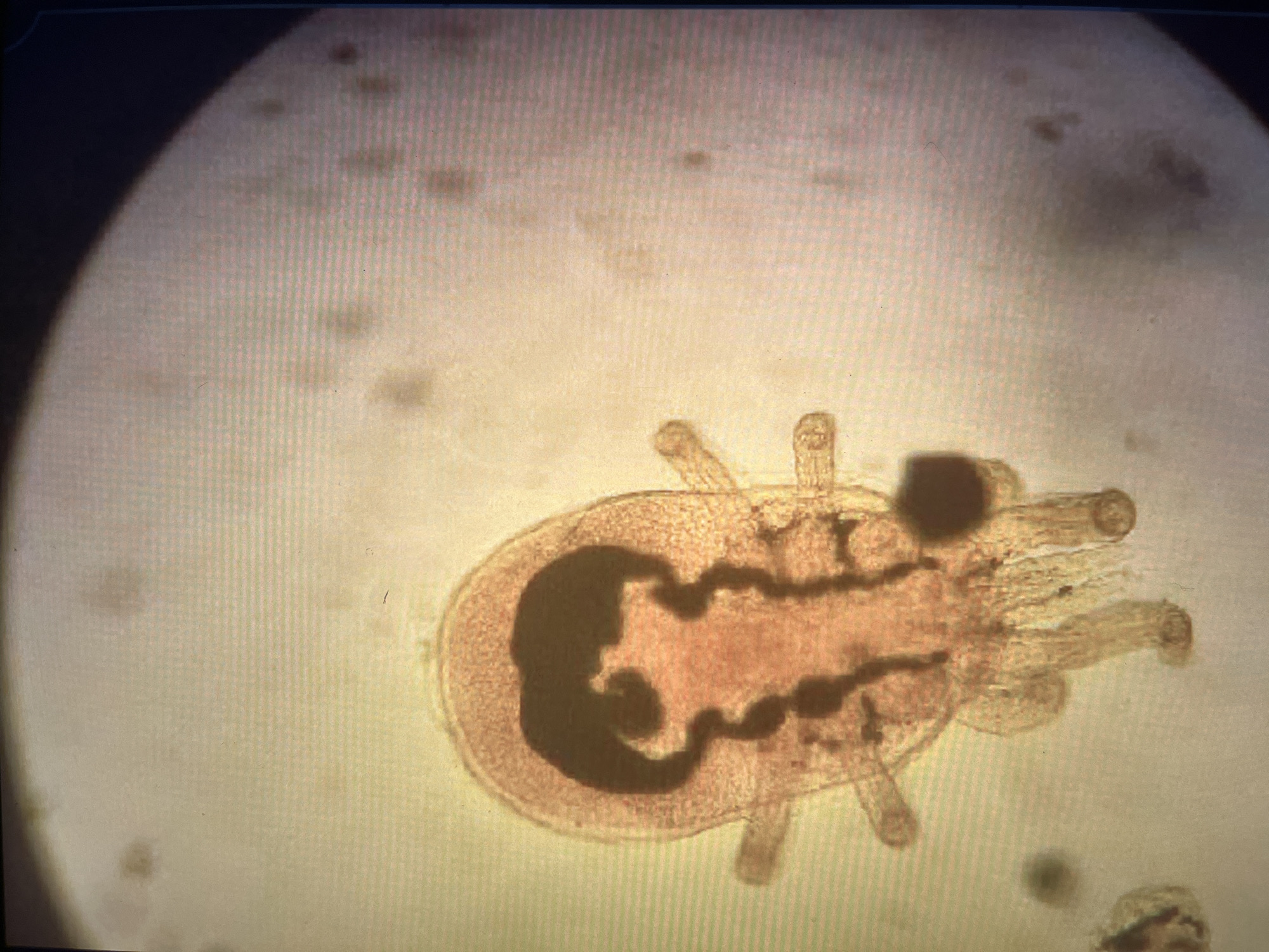 A microscopic image shows an organism with a translucent body, a dark, branched interior structure, and several protruding appendages. The organism is surrounded by a pale, speckled background. Location is Unknown, Unknown.