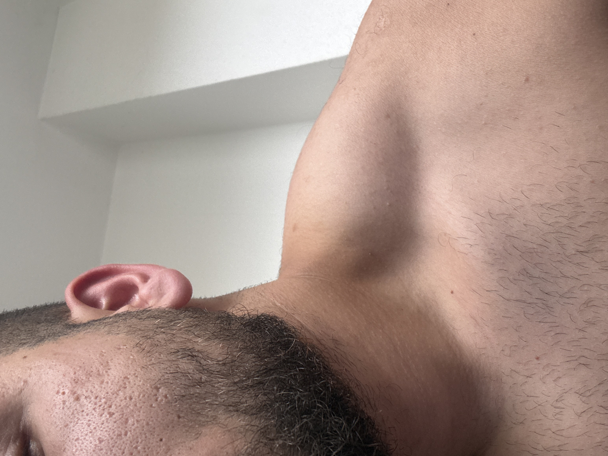 An image captured in Delmenhorst, Germany, depicts a close-up of the left side of a male subject's head, neck, and upper torso. The left side of the face features a dense dark beard, stubble, and skin with prominent pores and pockmarking (likely post-inflammatory changes) on the cheek. The left ear is clearly visible and appears anatomically normal. The neck, left shoulder, and upper chest display skin of a light-to-medium complexion, with fine, dark body hair and a discernible clavicle. Small moles are present on the shoulder and chest. The background comprises a plain, light-colored interior wall with an architectural corner feature casting shadows.