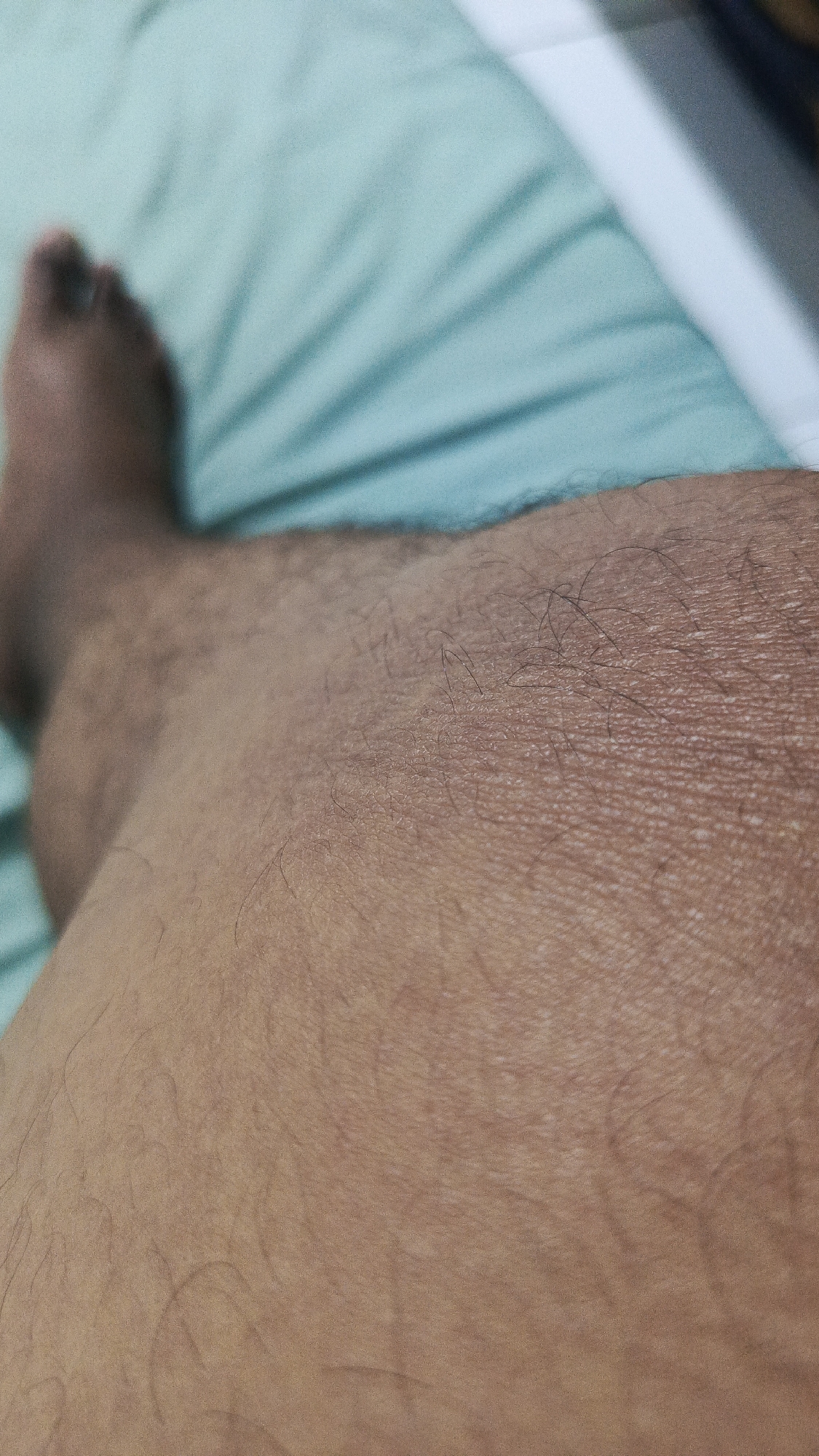 A close-up, overhead shot shows a person's left leg and foot resting on a light teal-colored sheet, likely in a bedroom or hospital room in Parung Panjang, Indonesia. The sheet is wrinkled, suggesting it has been disturbed. The person's skin is brown and appears to have fine hairs. The foot is out of focus and positioned to the left of the frame. The overall lighting is soft, and the image has a slightly grainy texture.