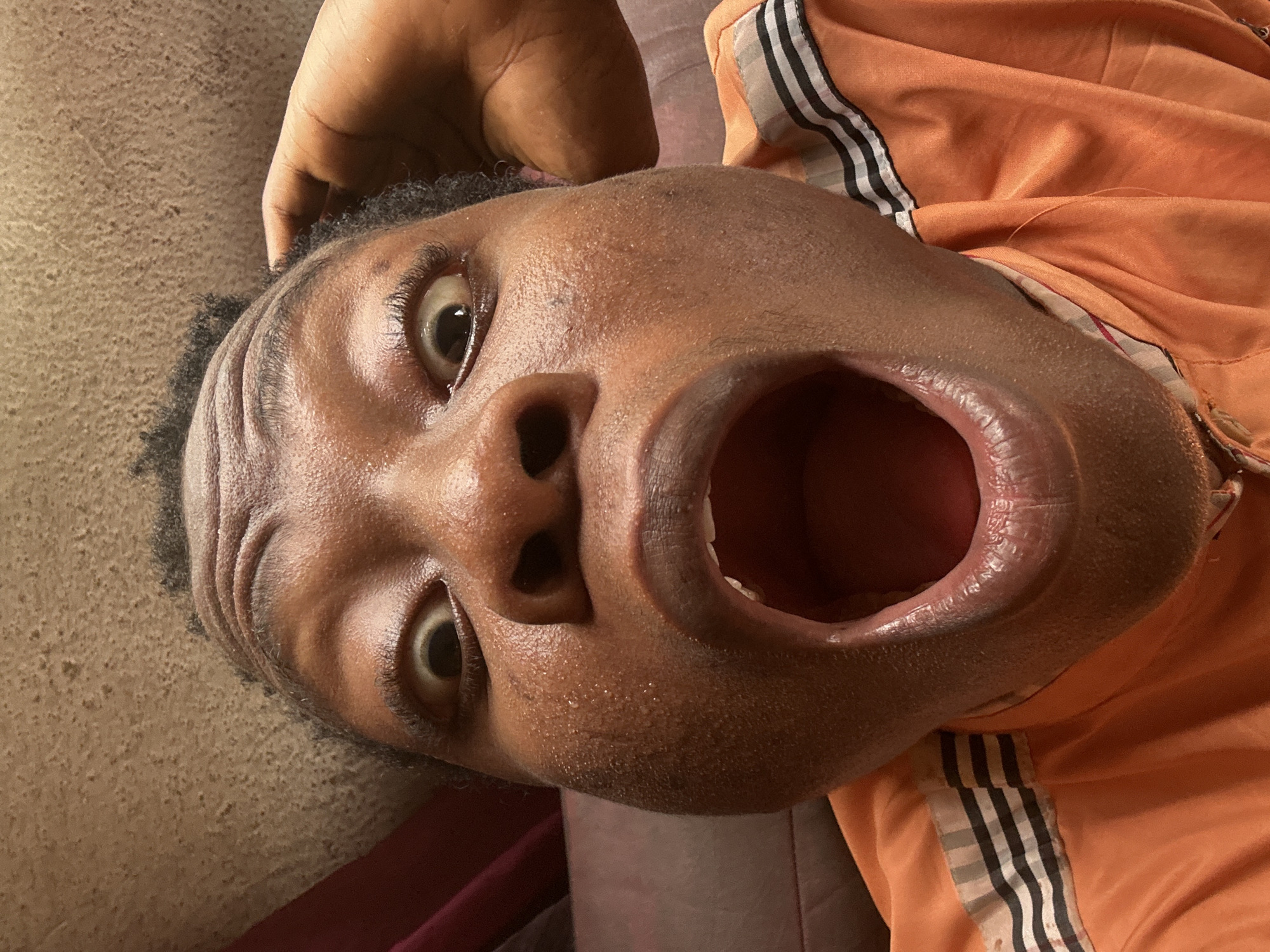 The image displays a close-up, rotated view of a person's head and upper torso. The person, who appears to have dark skin and short, dark, curly hair, is shown with an exaggerated facial expression: both eyes are wide open, and the mouth is agape, revealing the dark red interior. This expression suggests surprise, shock, excitement, or a playful yell.
A hand is visible in the upper part of the frame, resting near the top of the person's head. The person is wearing an orange garment, possibly a jacket or shirt, which features prominent white and black stripes along the side, resembling athletic wear or a tracksuit. The background is indistinct, with different textures and colors suggesting an indoor setting – one part appears to be a light brown, textured surface (like a wall or couch), and another part a darker, solid-colored fabric.
Notable details include the slightly shiny appearance of the person's skin. No specific time of day, weather, or location can be determined, and there is no visible text. The overall impression is a candid or deliberately humorous moment captured at a close range.