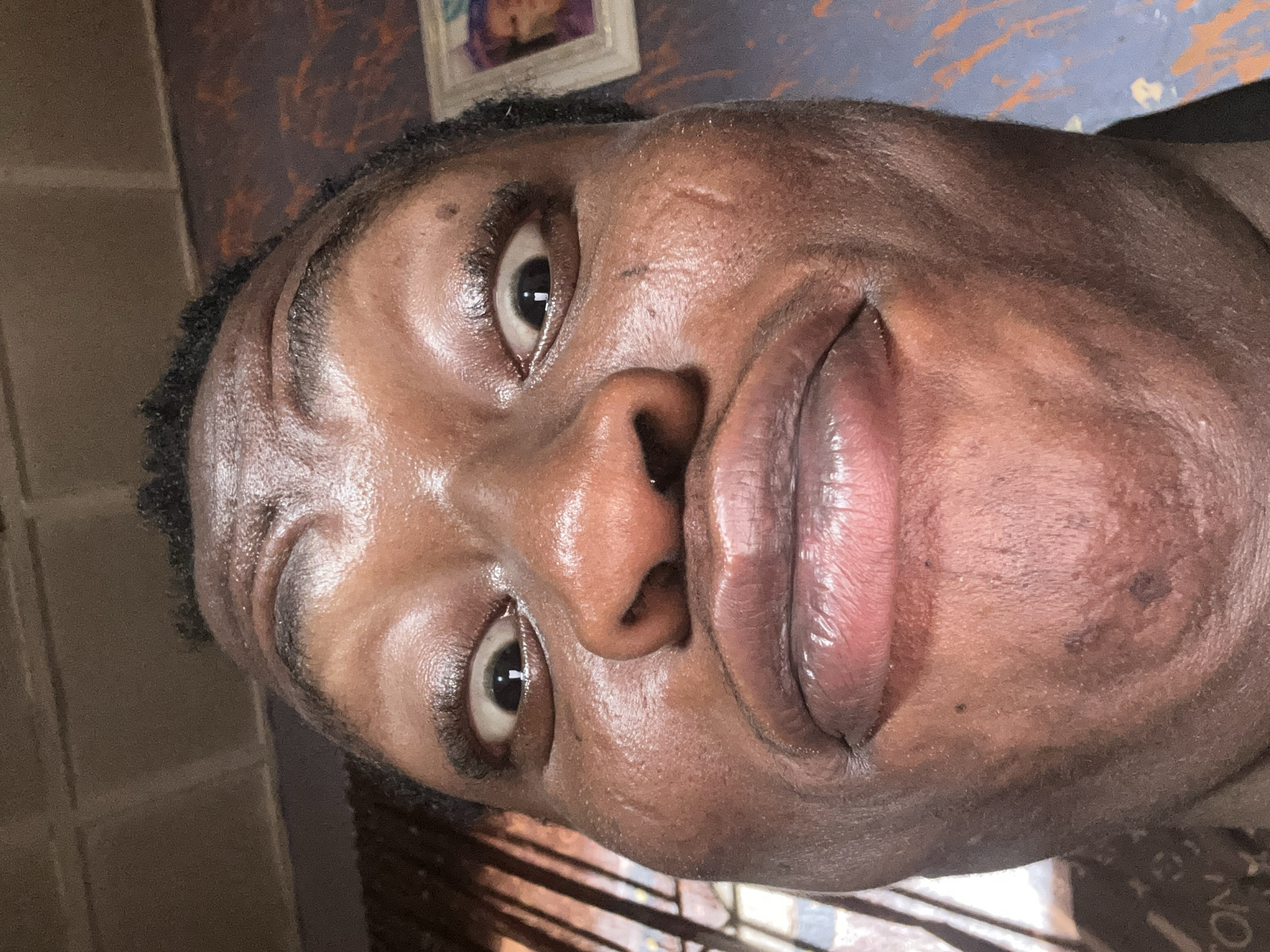 A close-up, tilted portrait of a person with dark skin. The person's face is the primary subject, with the nose, eyes, and lips prominently featured. Skin appears oily. The background shows a partially visible wall with a framed picture and indistinct patterns. Location: Unknown, Unknown.