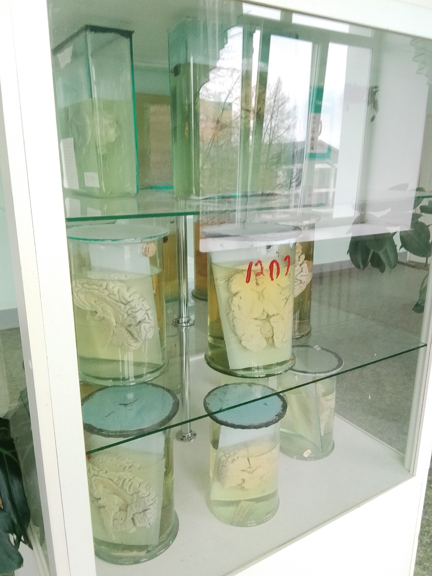 The image depicts a white glass display cabinet containing preserved human brains in jars filled with a transparent liquid. The jars are arranged on three shelves. Several jars contain pieces of paper with writing on them. A jar in the middle shelf has the number "1201" written in red. The location appears to be in Chaikovsky, Russia, based on visual clues and contextual possibilities. Outside the cabinet, a window reflects an exterior view of trees and buildings. A potted plant is visible to the right of the cabinet.